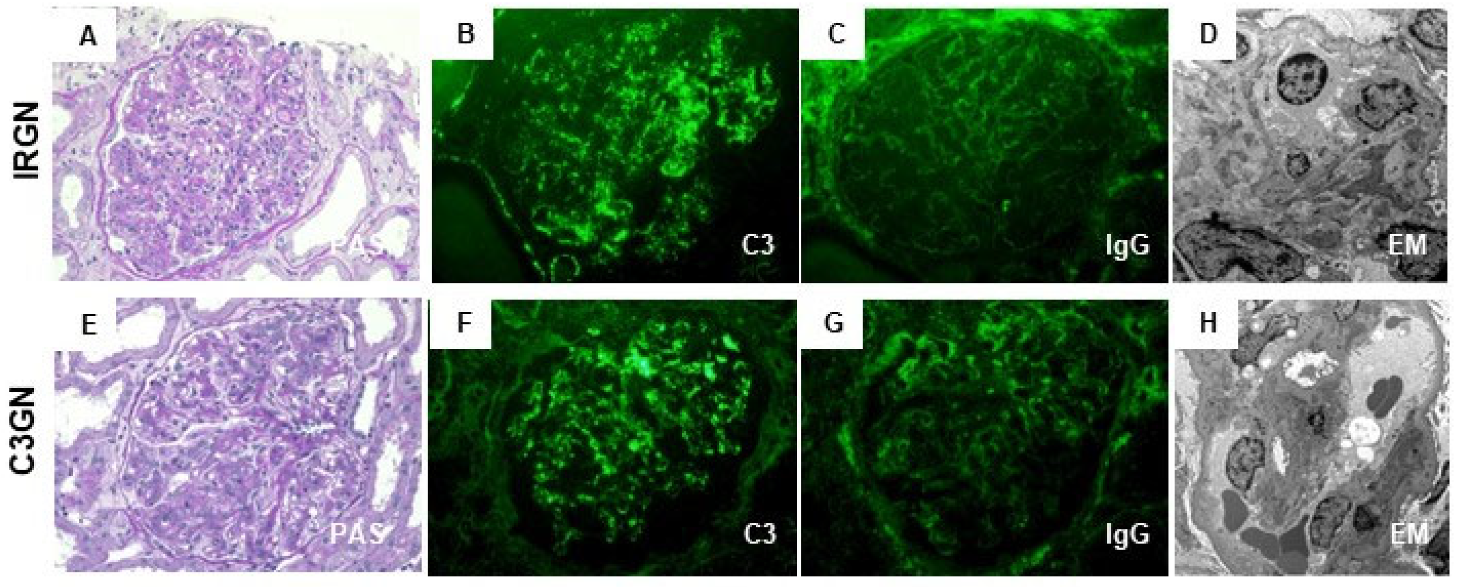 IJMS Free FullText ClinicoPathogenic Similarities and Differences
