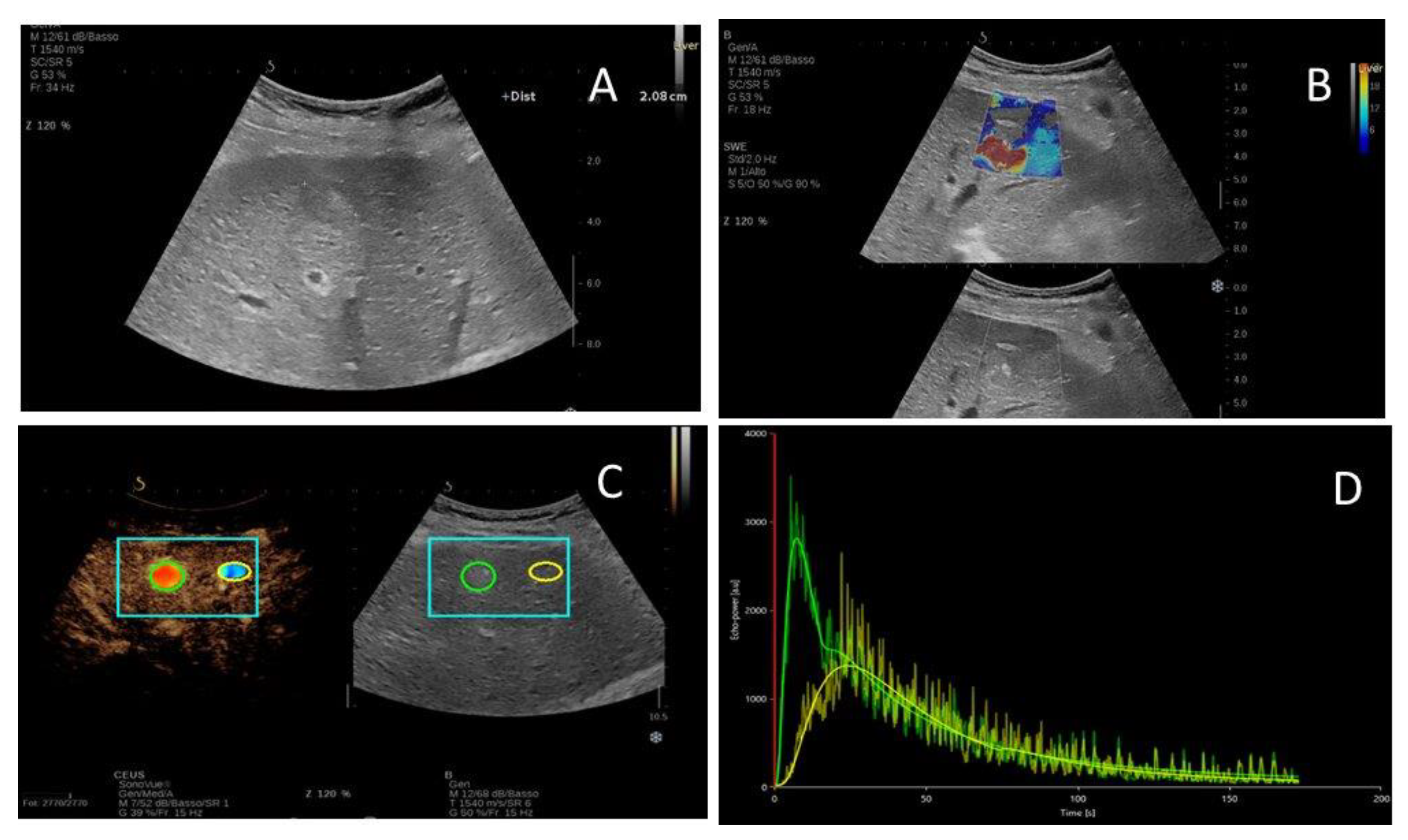 Ijms 24 08548 g001 Ijms 24 08548 g001