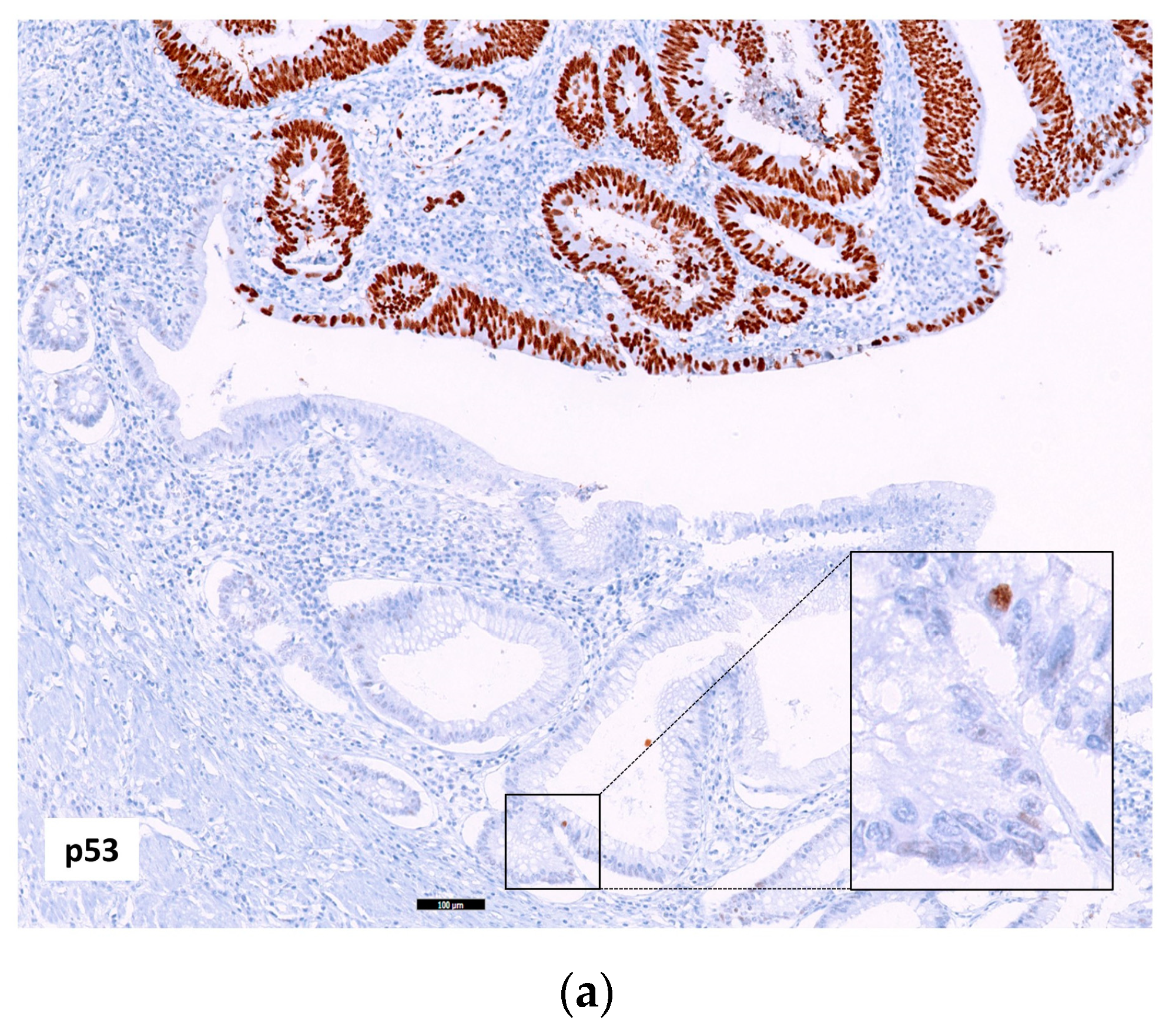 Ijms 24 08655 g004a Ijms 24 08655 g004a