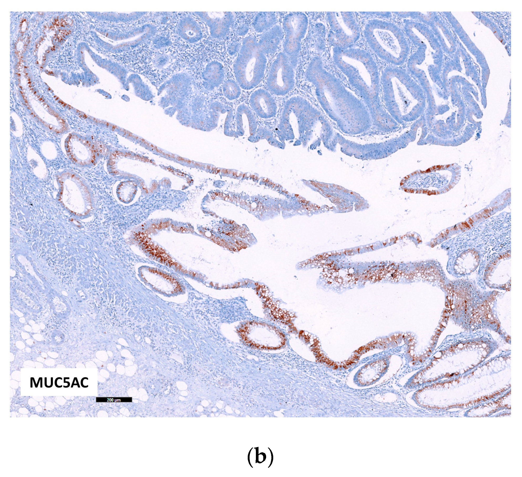 Ijms 24 08655 g004b Ijms 24 08655 g004b