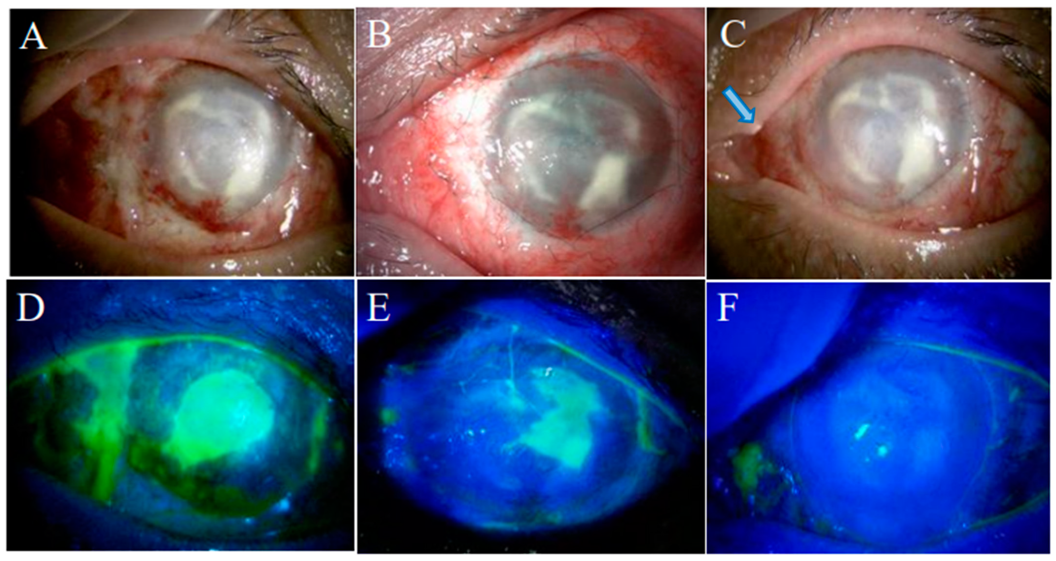 Ijms 24 08926 g005 Ijms 24 08926 g005