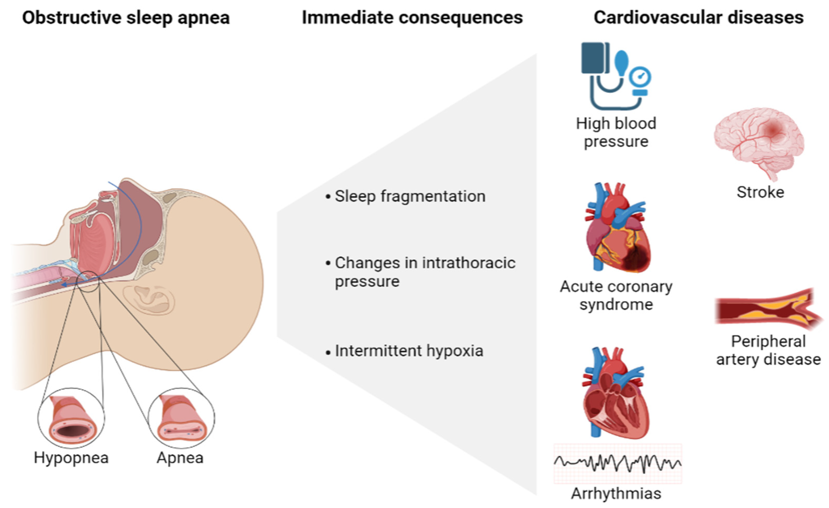 Briialexia And Sleep: The Surprising Link