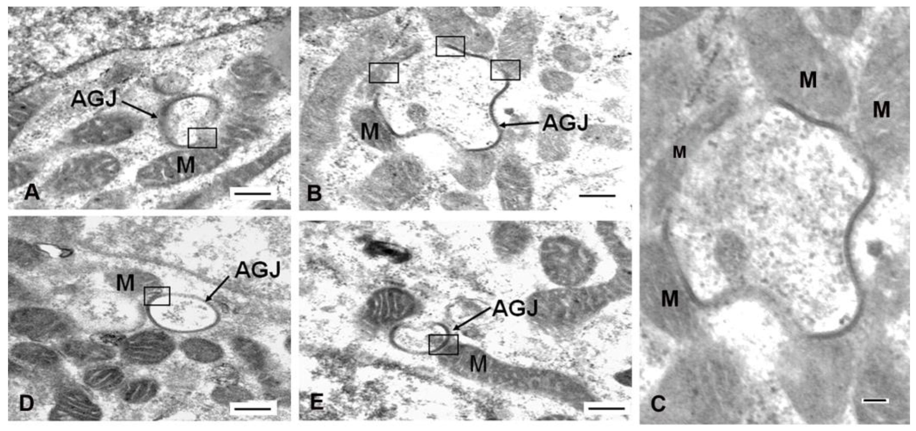 IJMS | Free Full-Text | Mitochondrial Connexins and Mitochondrial Contact  Sites with Gap Junction Structure