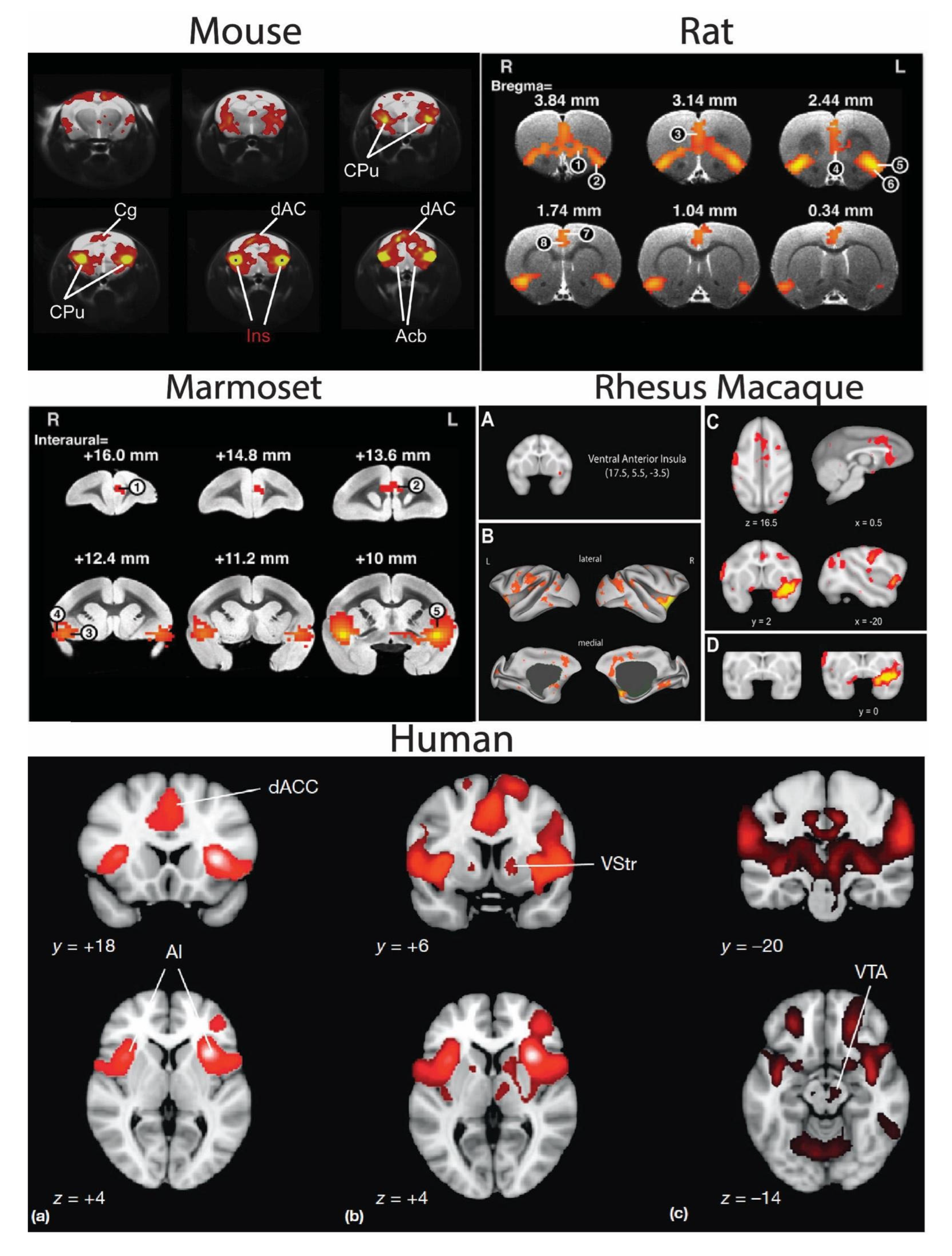 Where is Cingulate Cortex? A Cross-Species View: Trends in