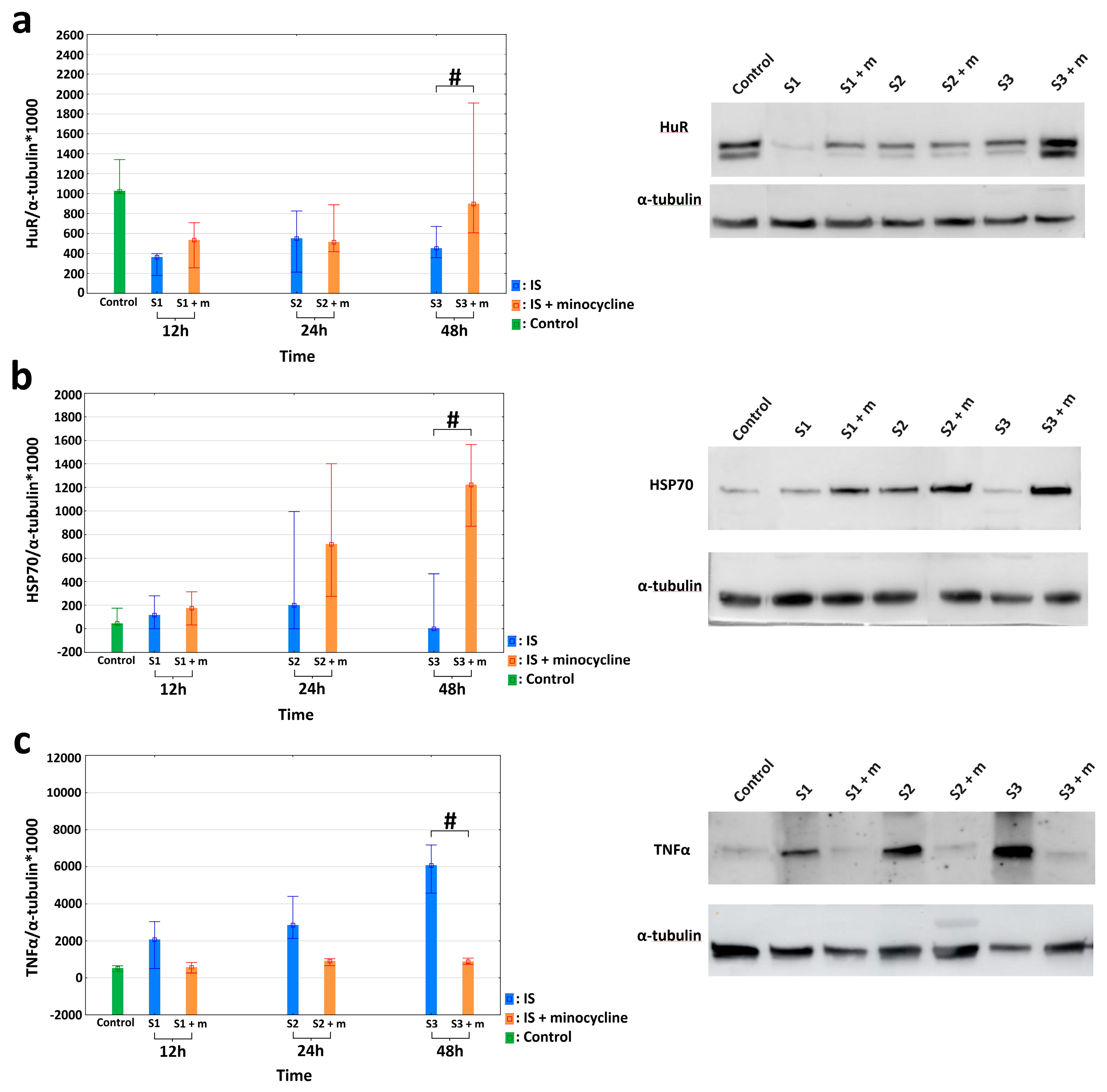 Ijms 24 09446 g004 Ijms 24 09446 g004