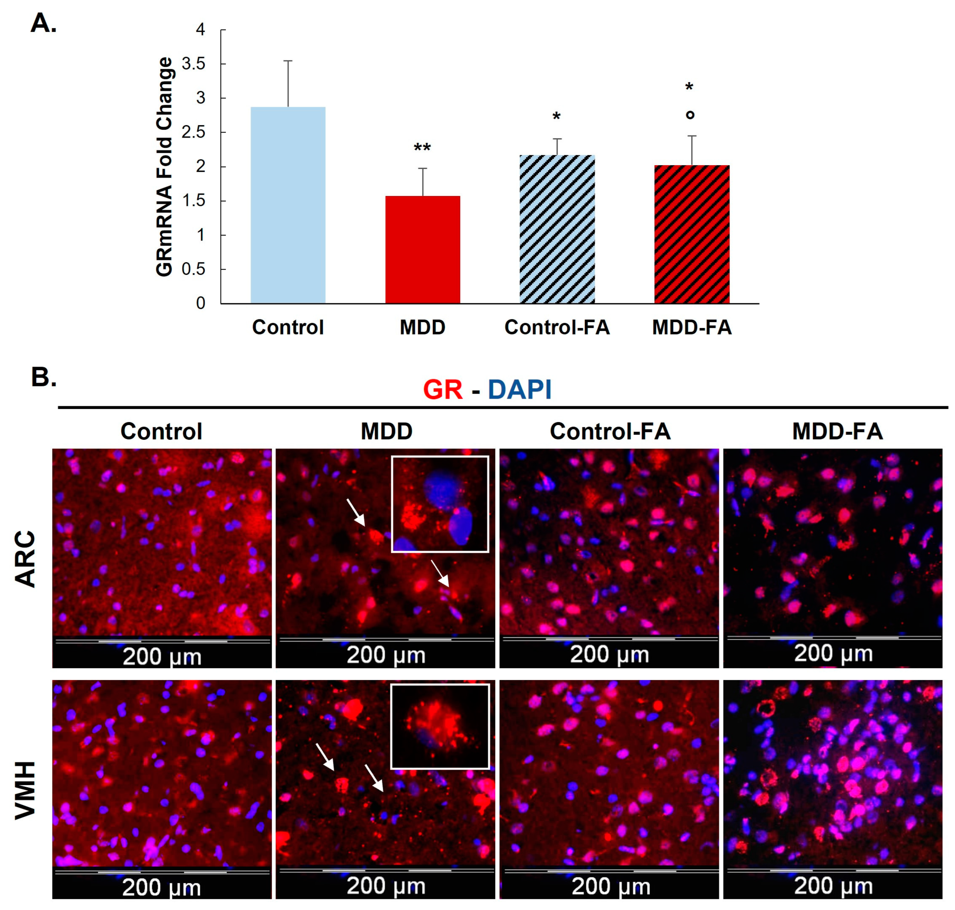 Ijms 24 09847 g002 Ijms 24 09847 g002
