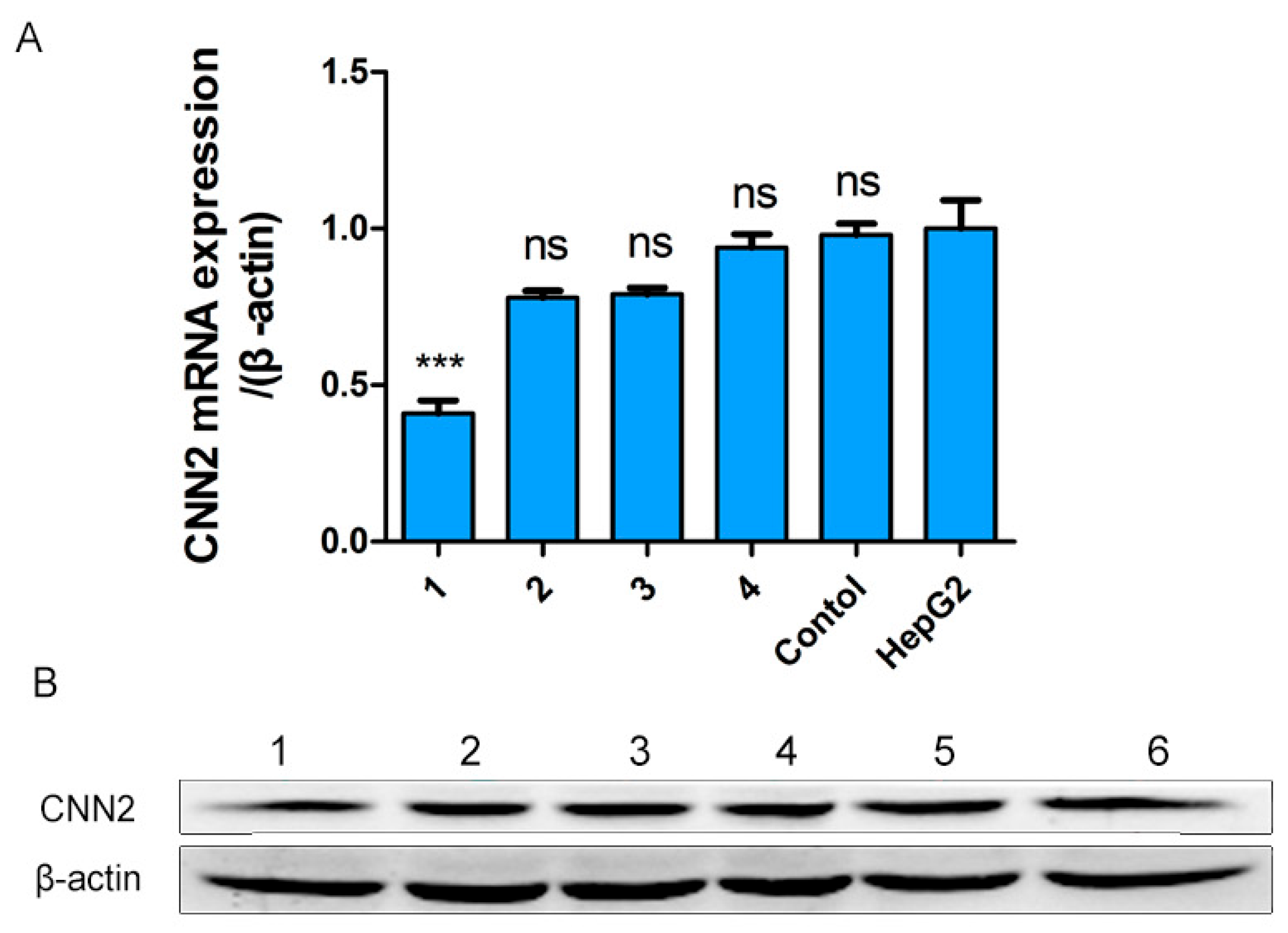 Ijms 24 09864 g006 Ijms 24 09864 g006