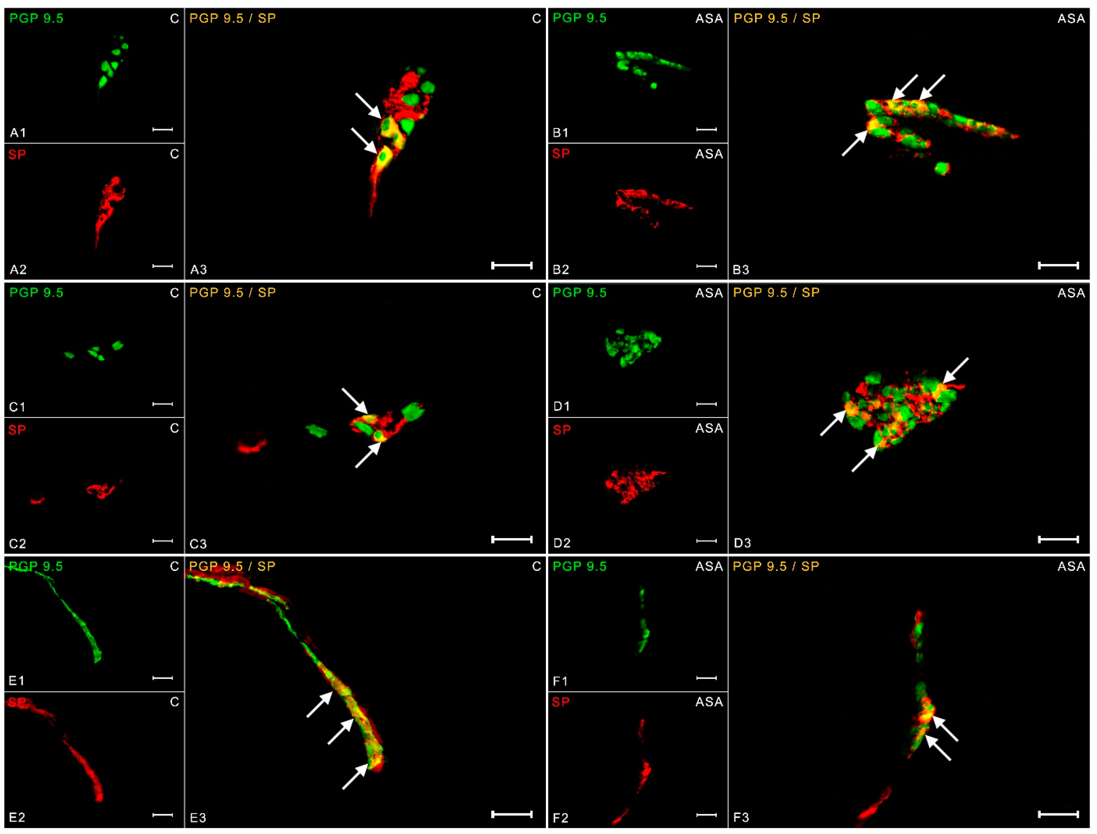 Ijms 24 09871 g004 Ijms 24 09871 g004