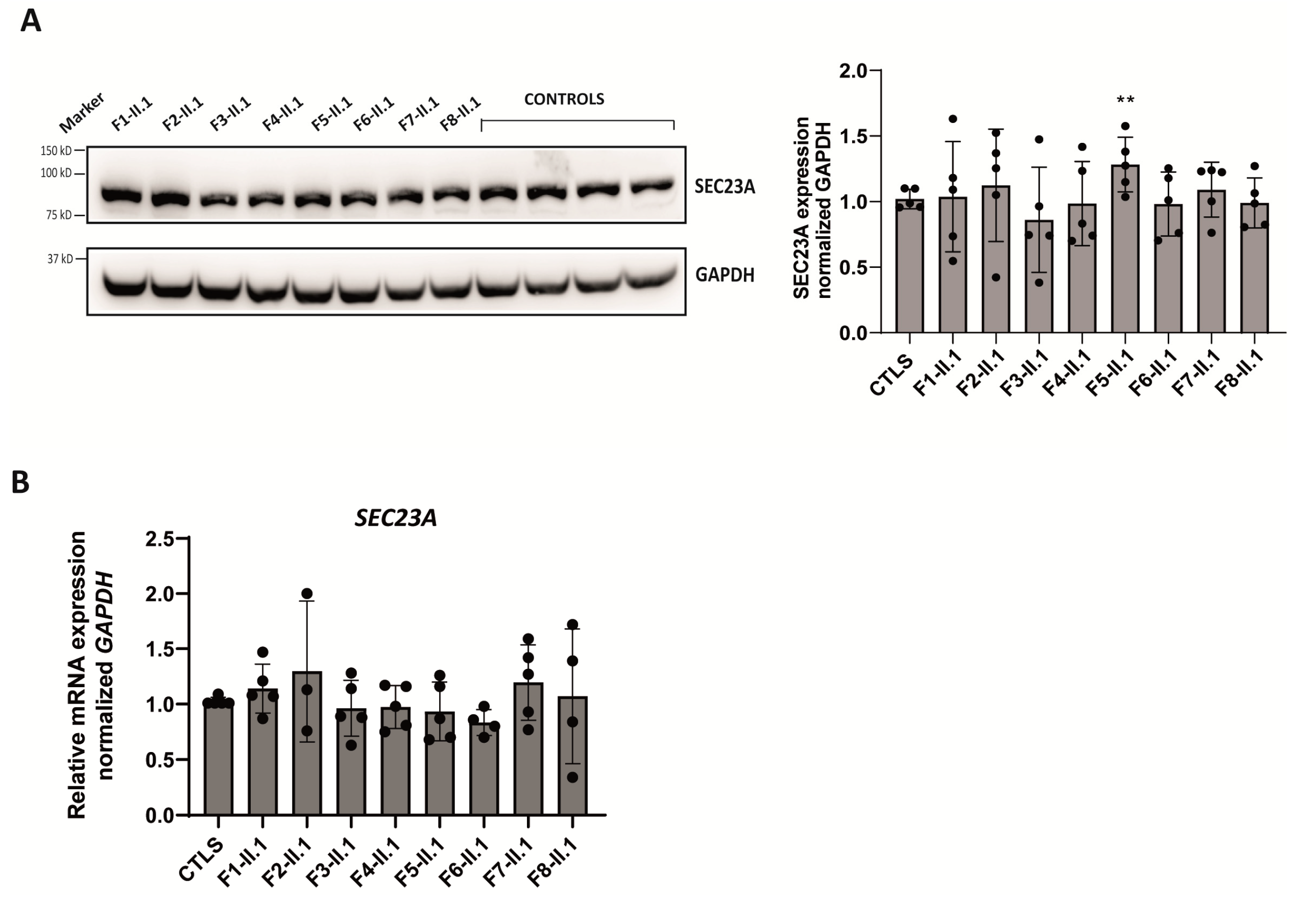 Ijms 24 09935 g005 Ijms 24 09935 g005