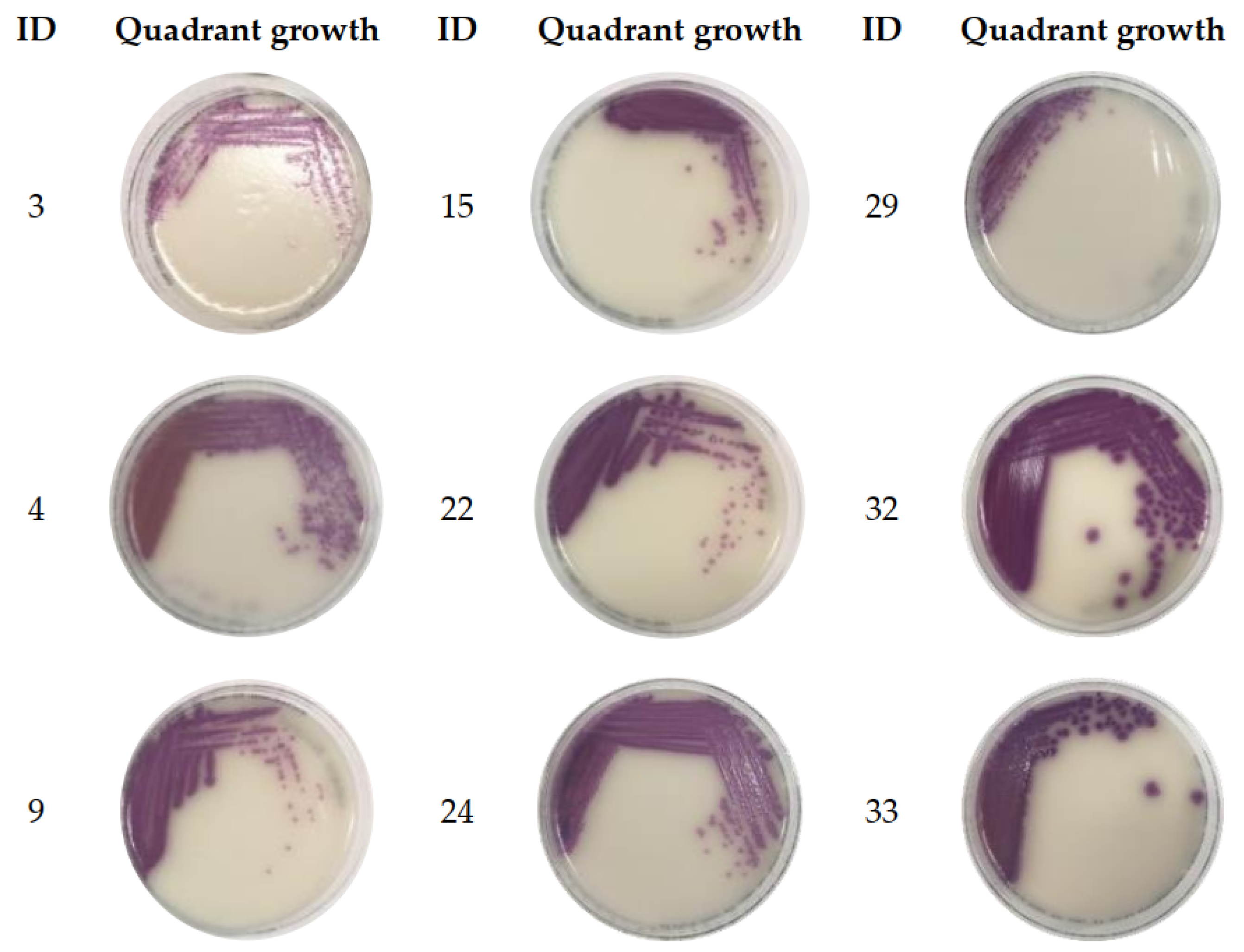 What Does Salmonella Poop Look Like  