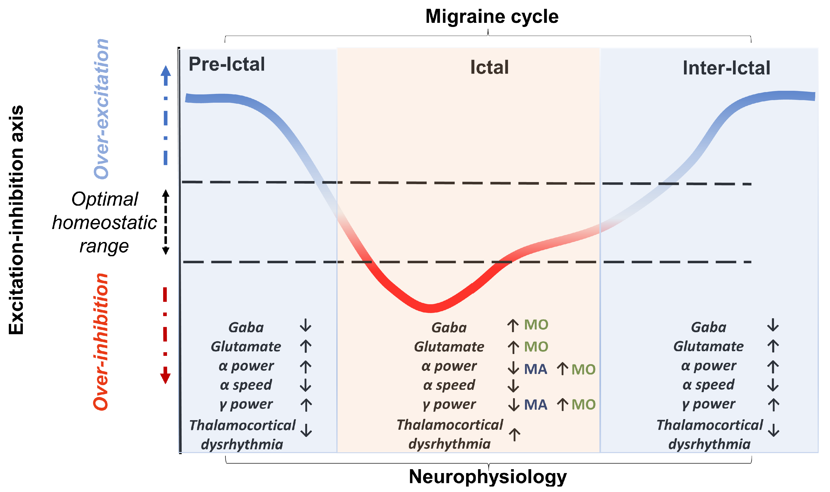 Ma migraine