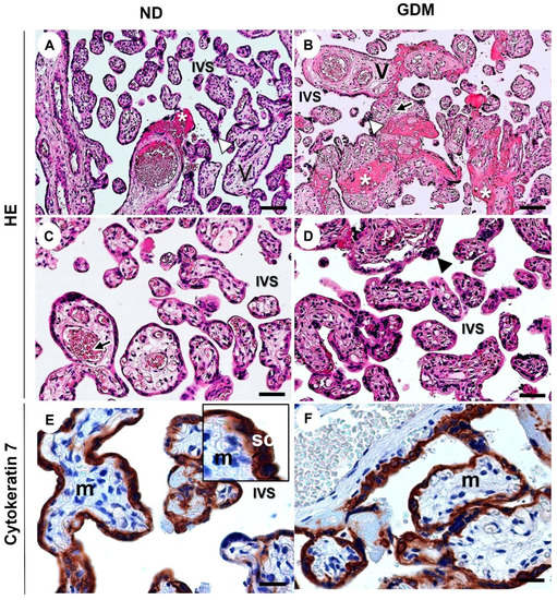 The Role of Annexin A1 in DNA Damage Response in Placental Cells