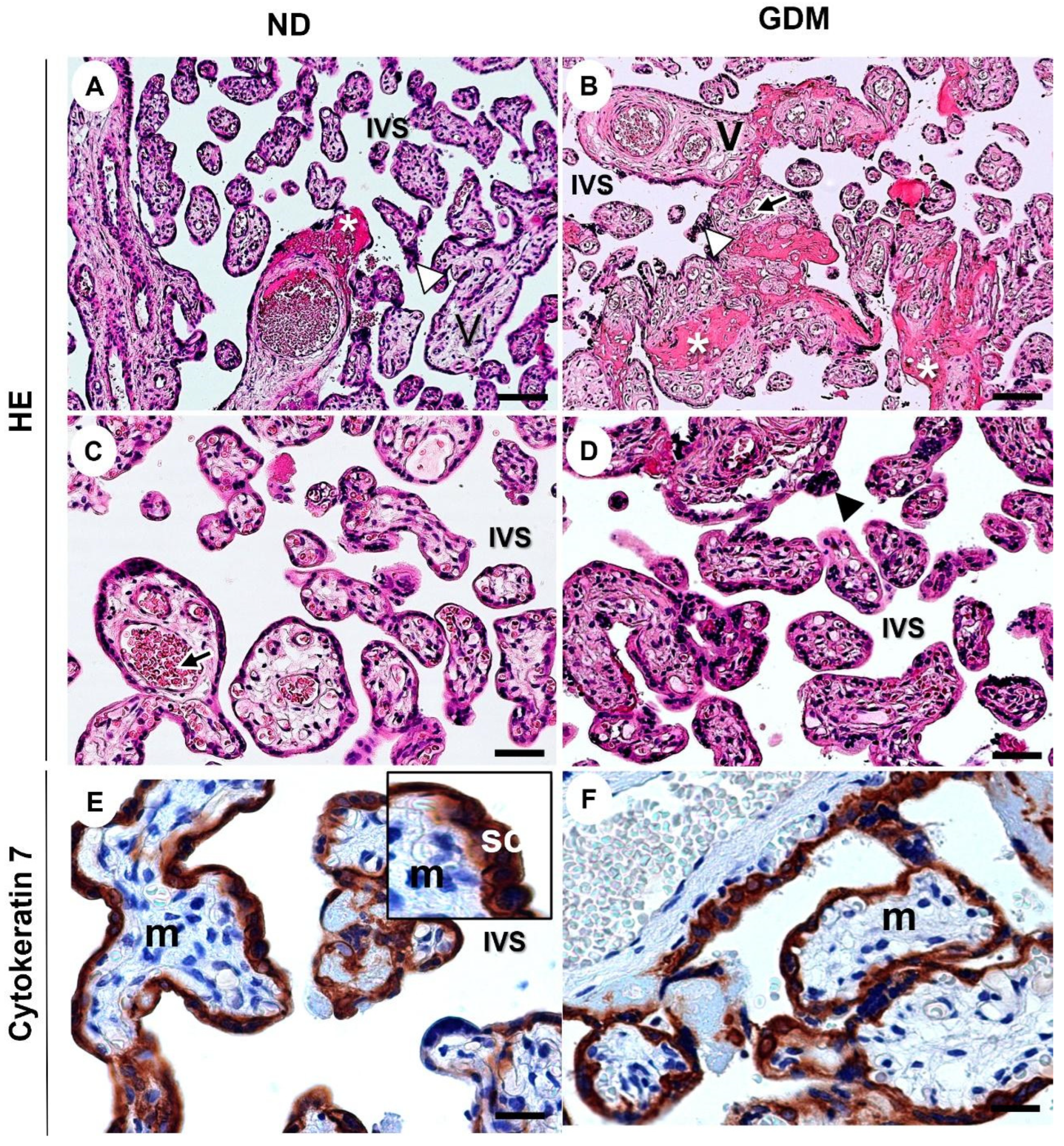 Ijms 24 10155 g004 Ijms 24 10155 g004