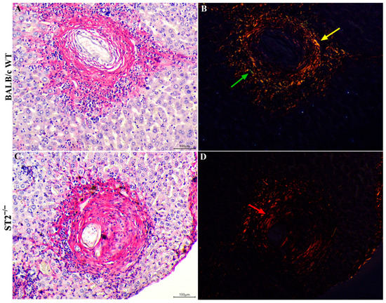 Role of the IL-33/ST2 Activation Pathway in the Development