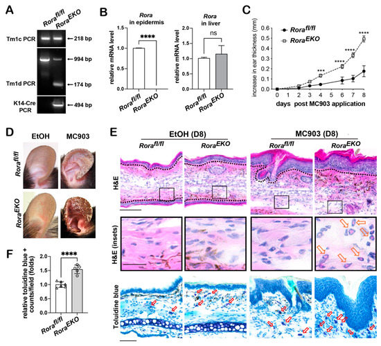 IJMS Free FullText Epidermal Loss of RORα Enhances Skin