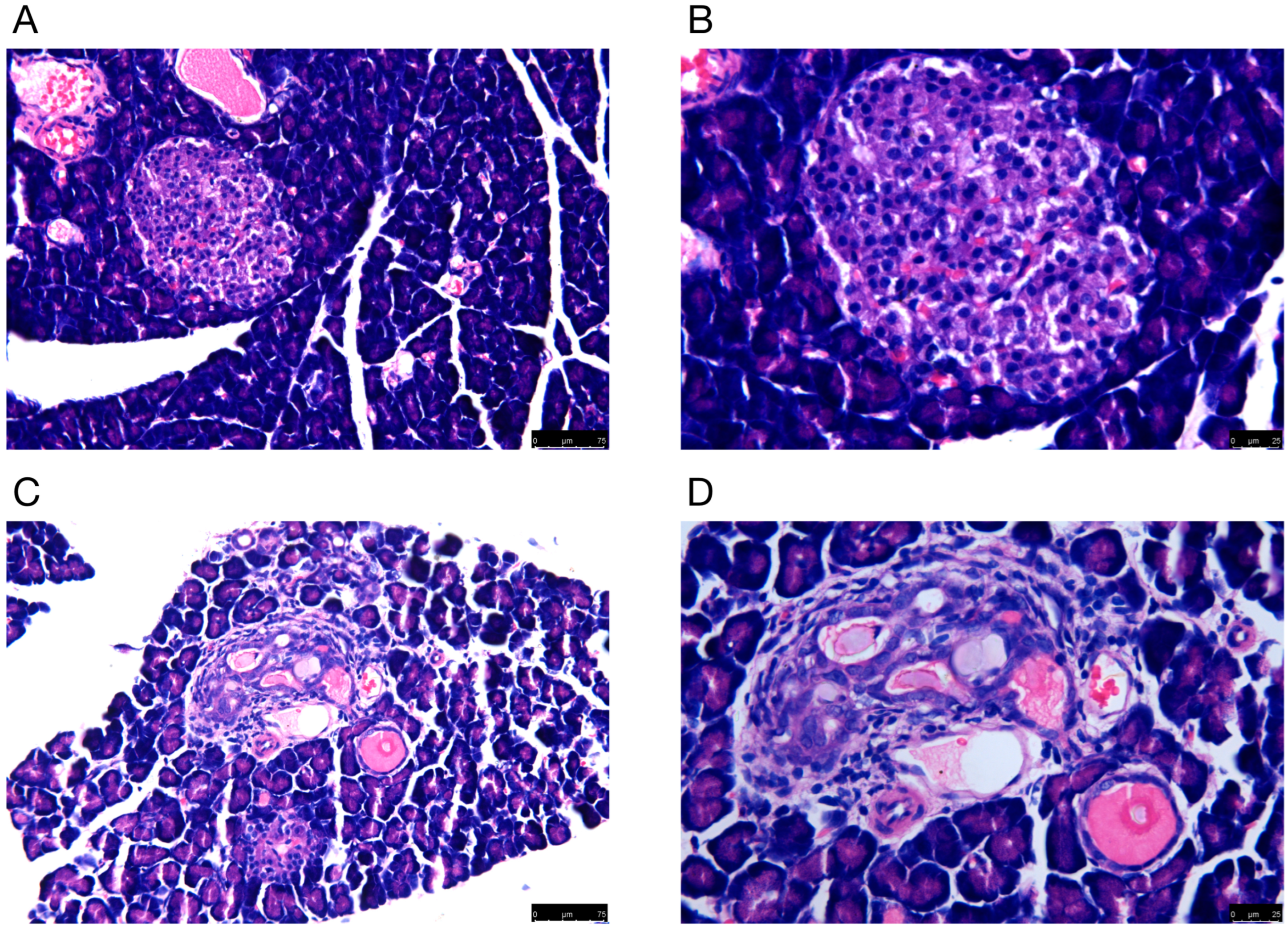 Small RNA Sequencing Analysis of STZ-Injured Pancreas