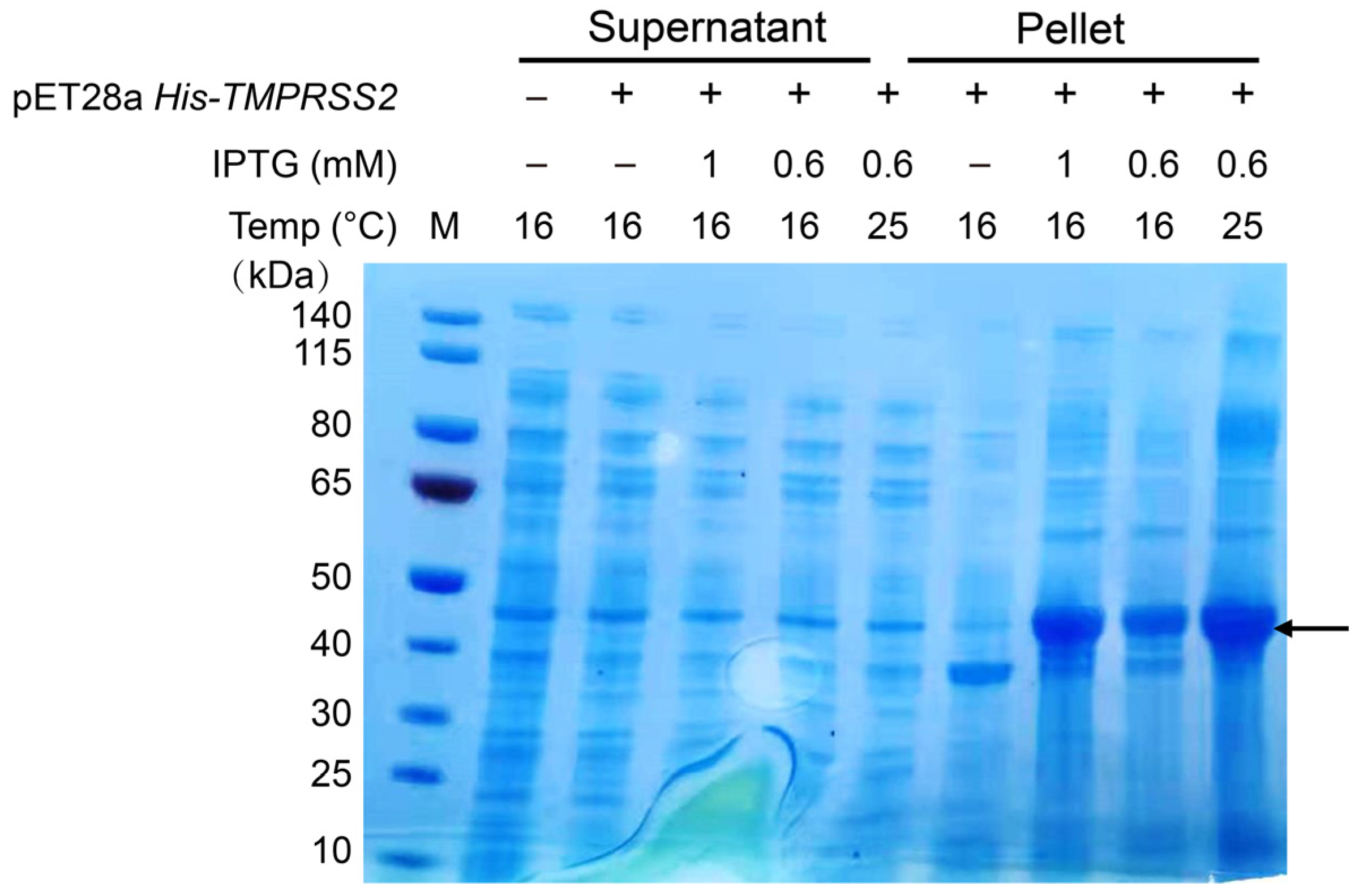IJMS Free FullText Improving Soluble Expression of SARSCoV2