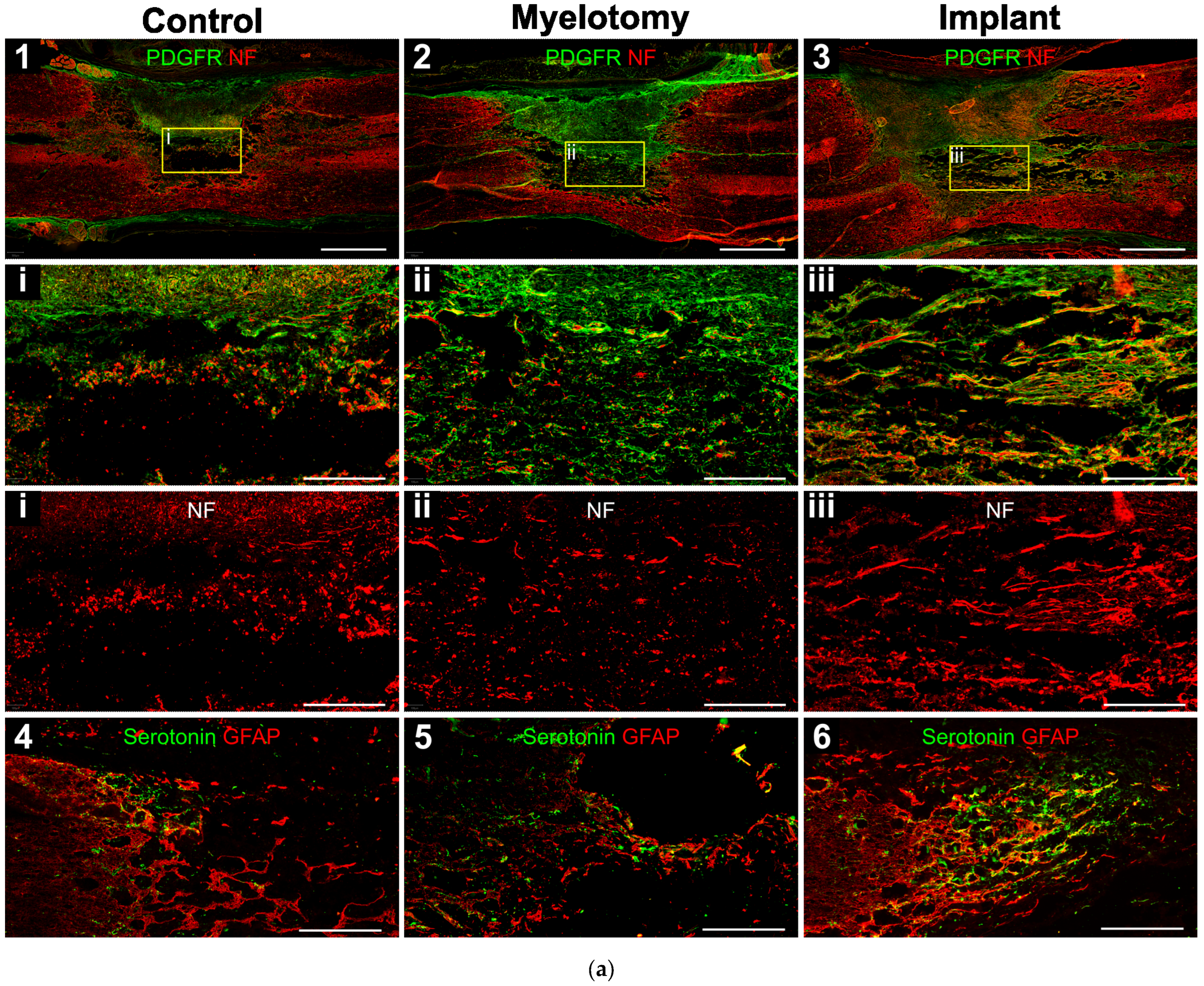 Ijms 24 11102 g003a Ijms 24 11102 g003a