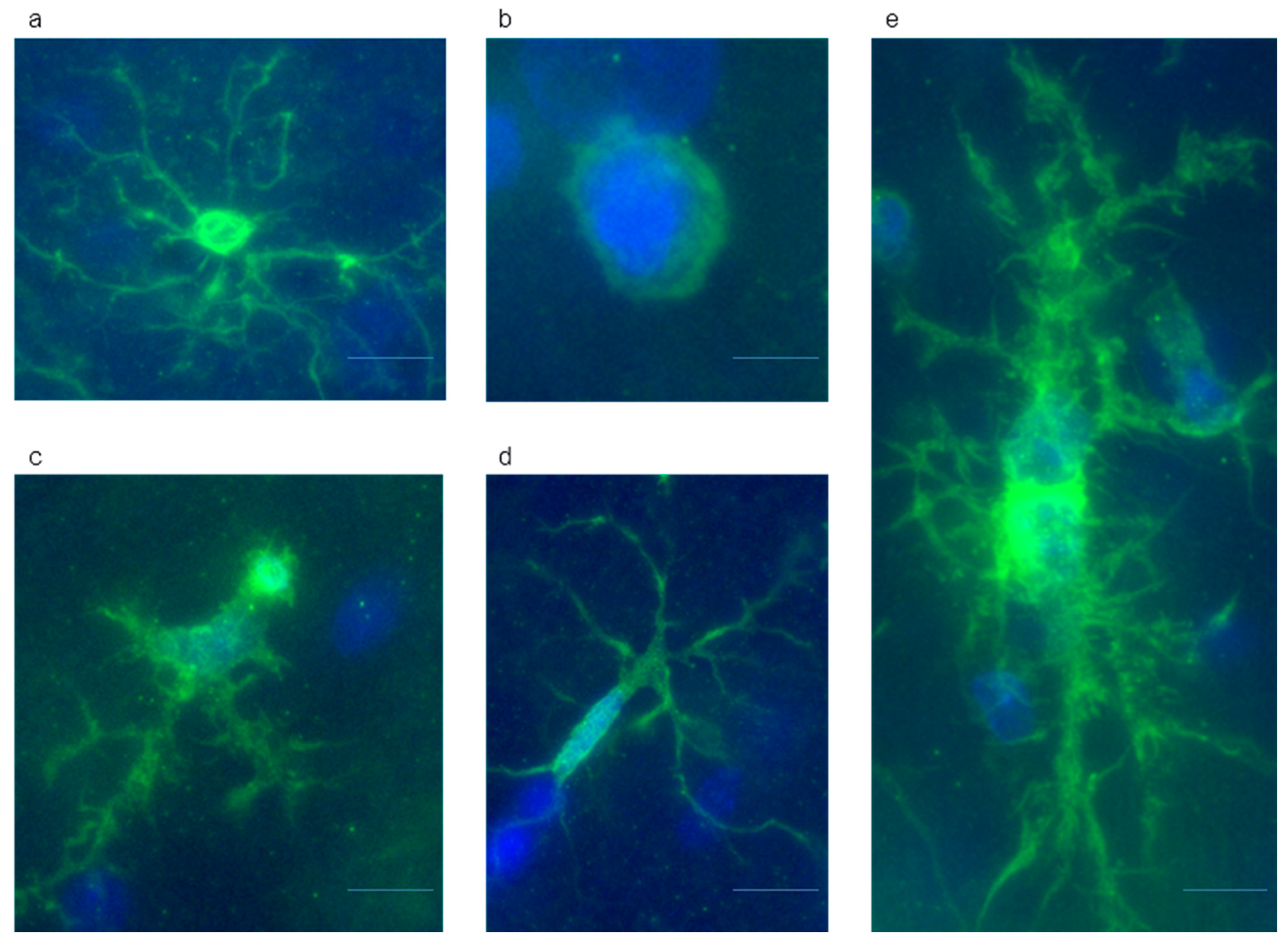 Ijms 24 11147 g008 Ijms 24 11147 g008