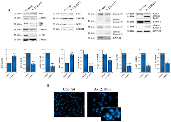 MCL1 Inhibition Overcomes the Aggressiveness Features of Triple ...