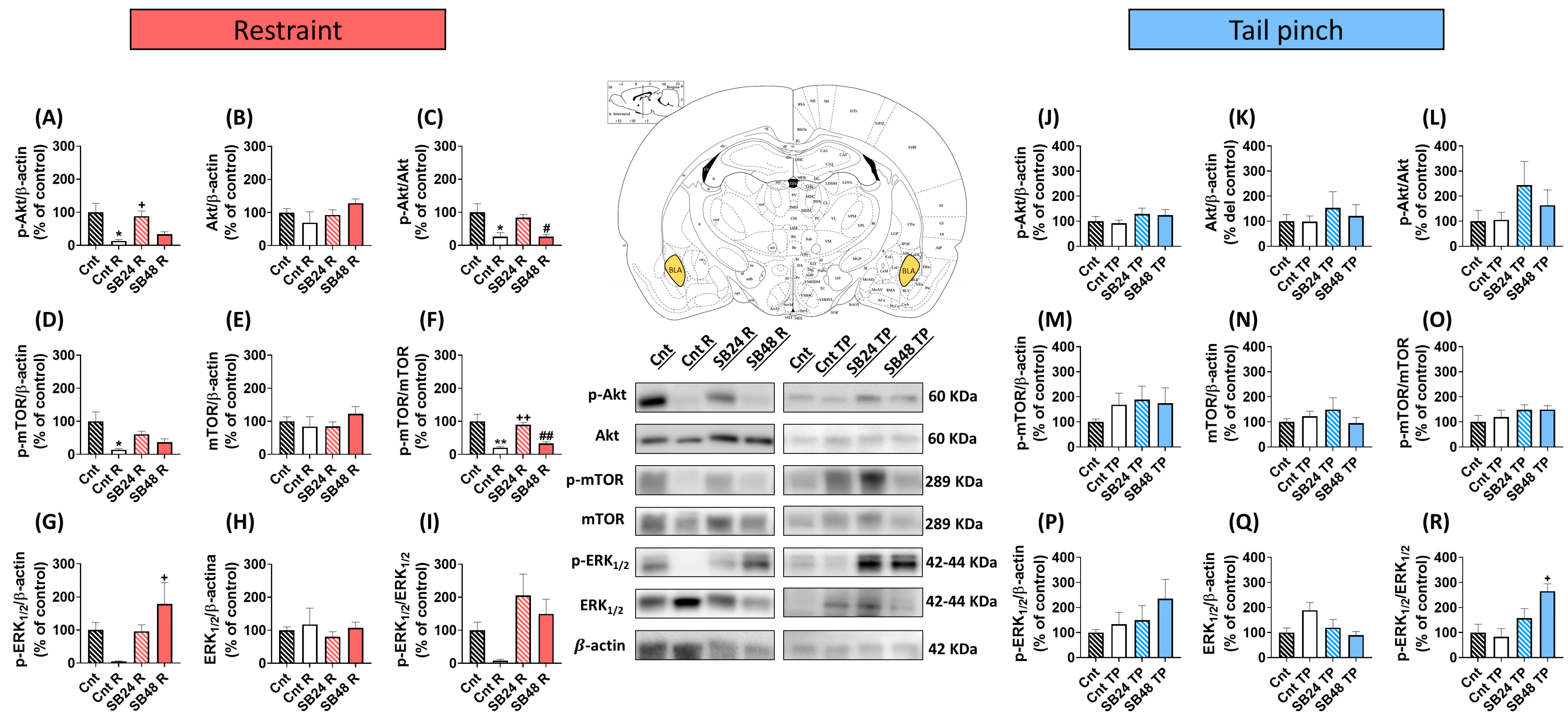 Ijms 24 11214 g003 Ijms 24 11214 g003