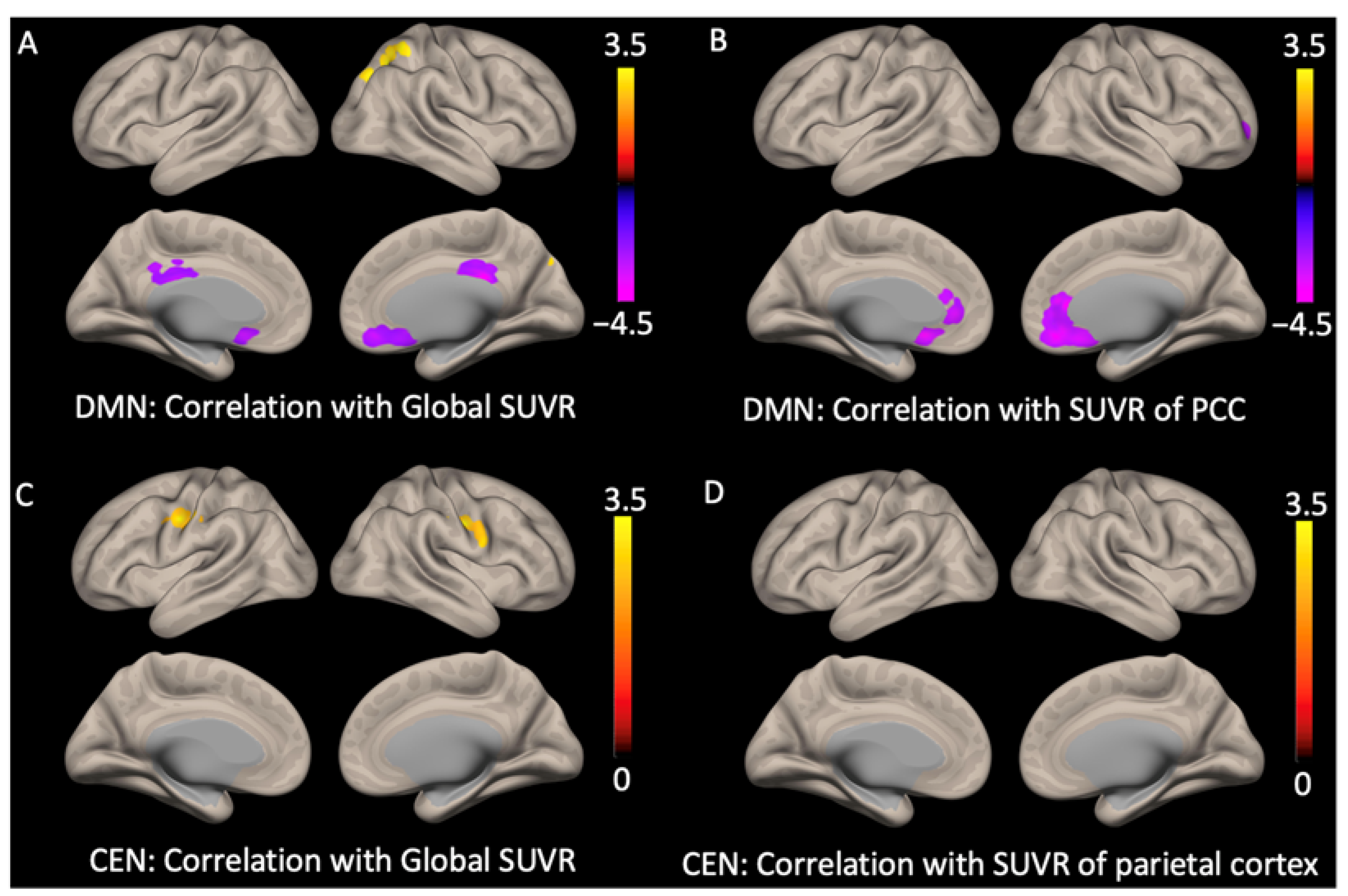 Cognitive Normal Older Adults with APOE-2 Allele Show a