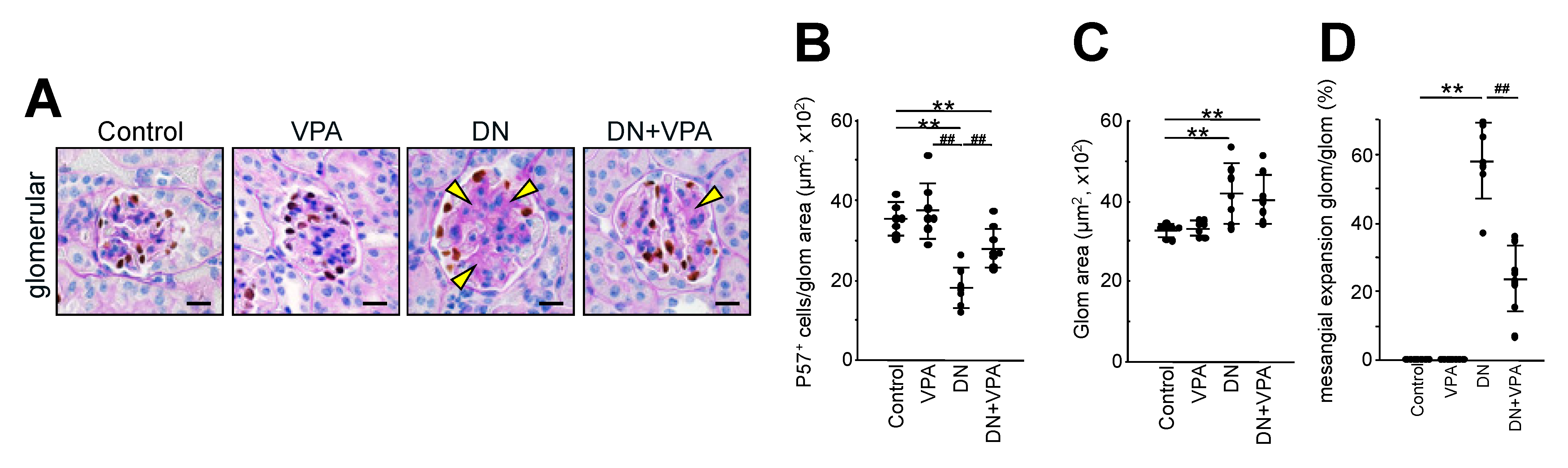 Ijms 24 11355 g004 Ijms 24 11355 g004