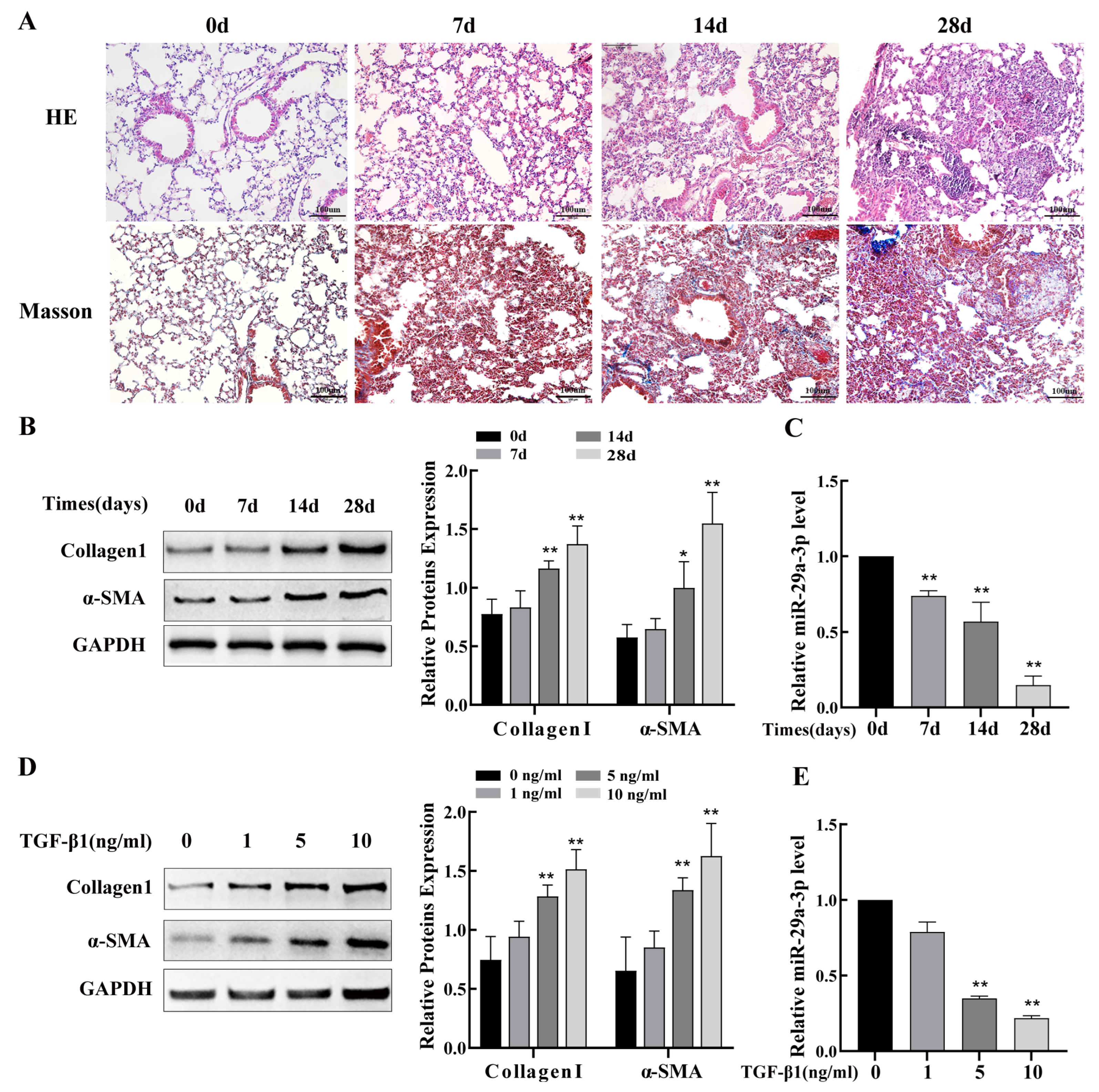 miR-29a-3p Regulates Autophagy by Targeting Akt3-Mediated