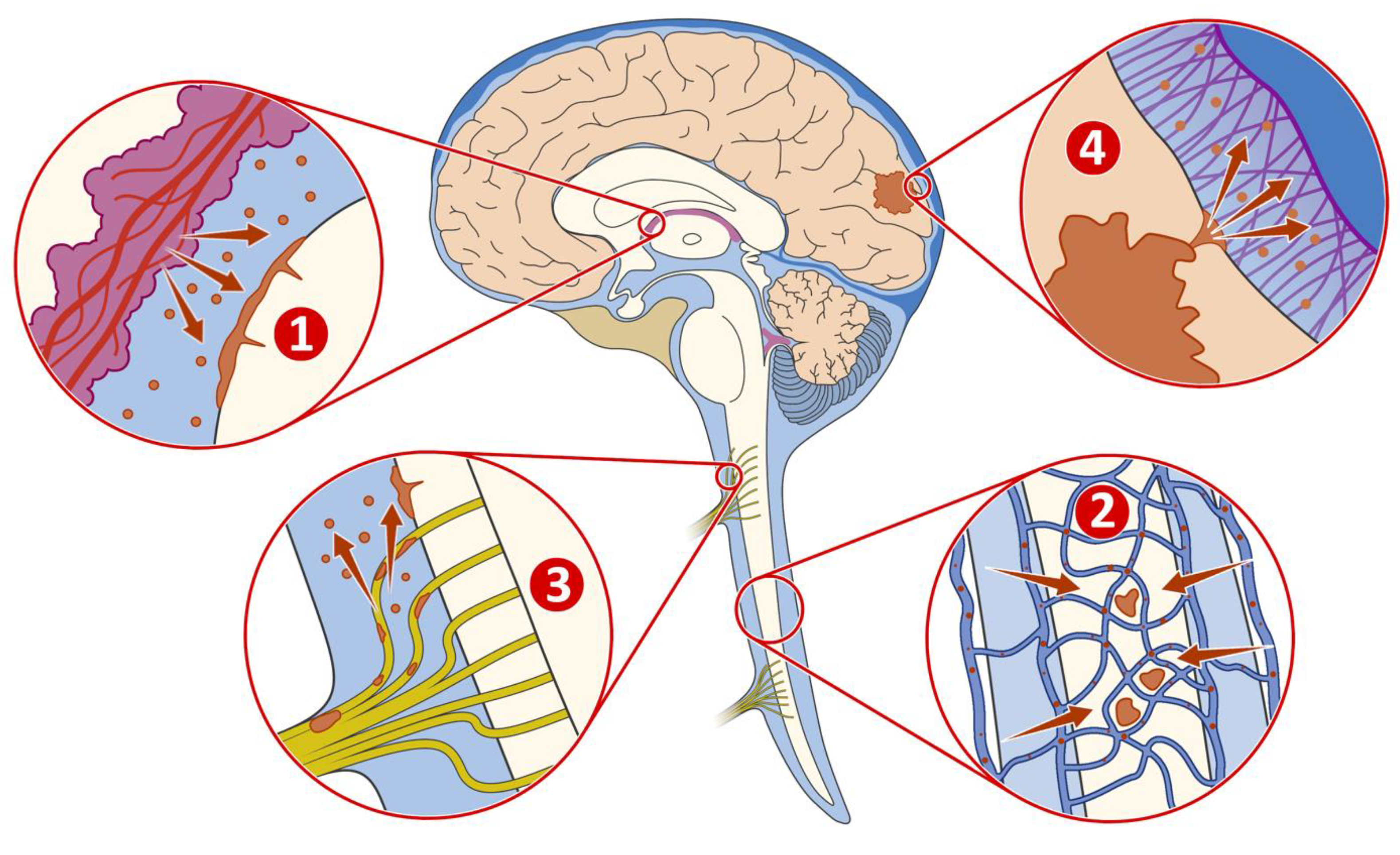 8-185 gray vs. white matter in the CNS Diagram