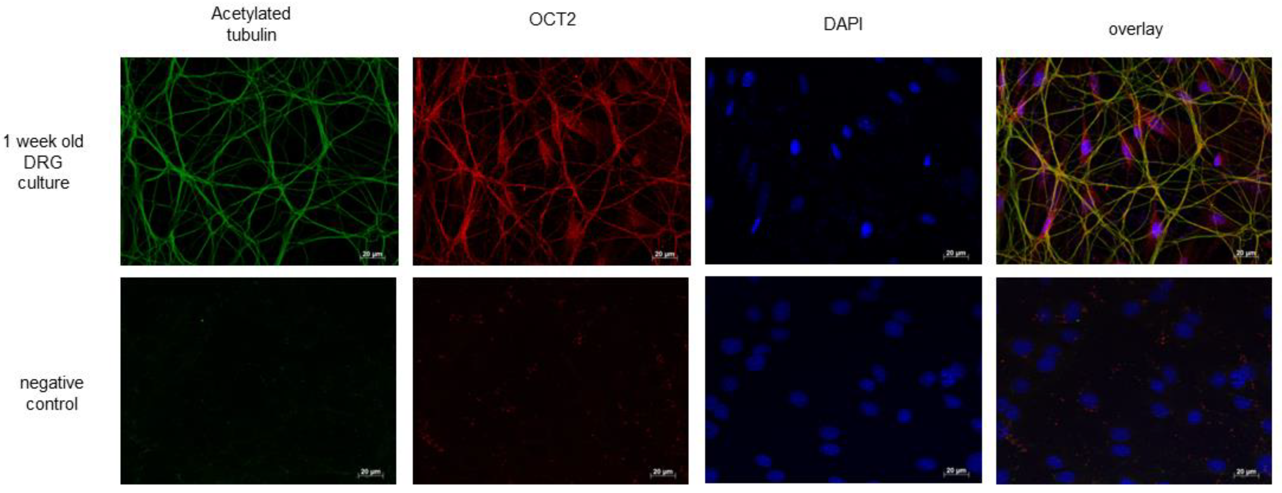 Ijms 24 11486 g008 Ijms 24 11486 g008
