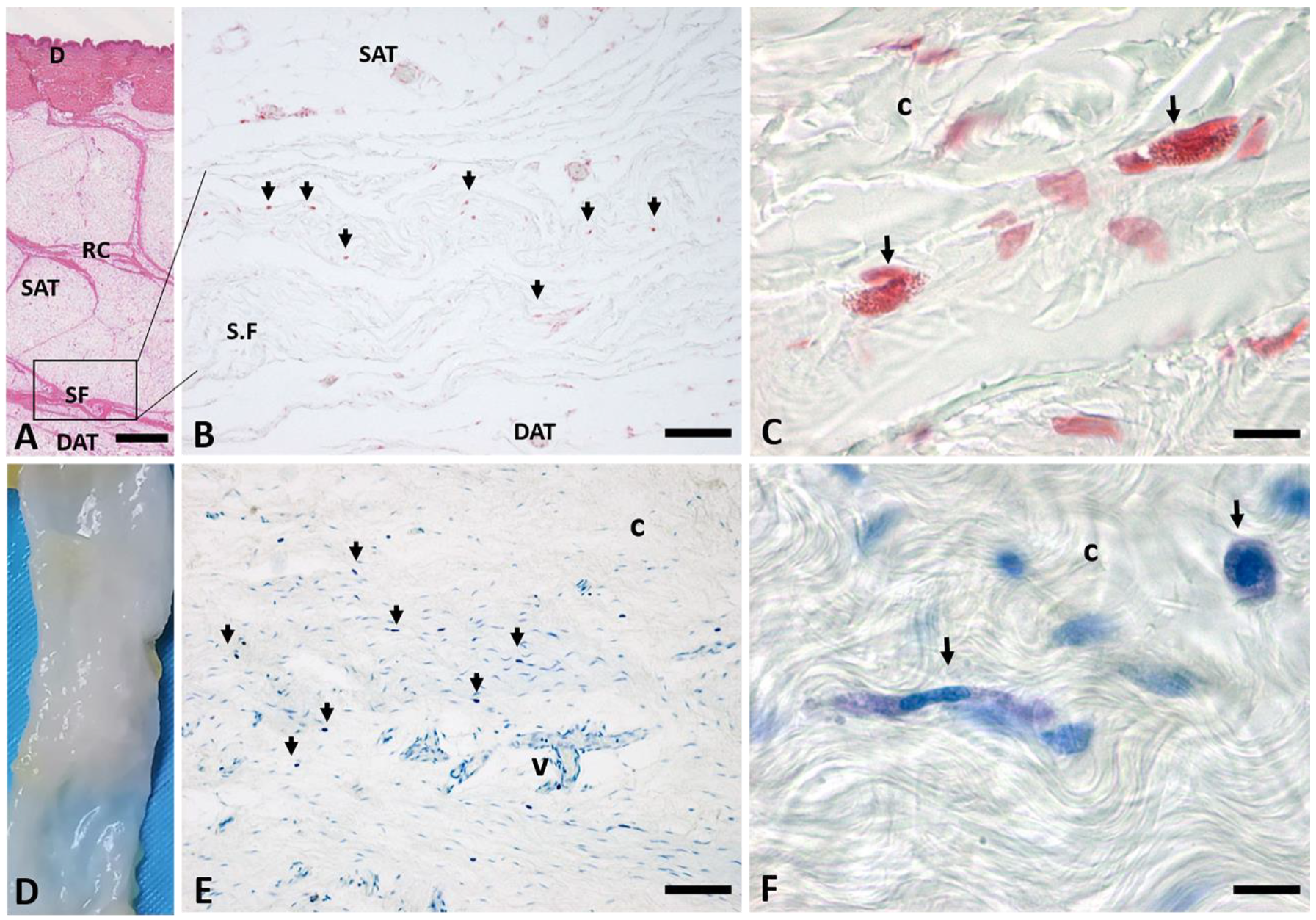 Ijms 24 11599 g001 Ijms 24 11599 g001