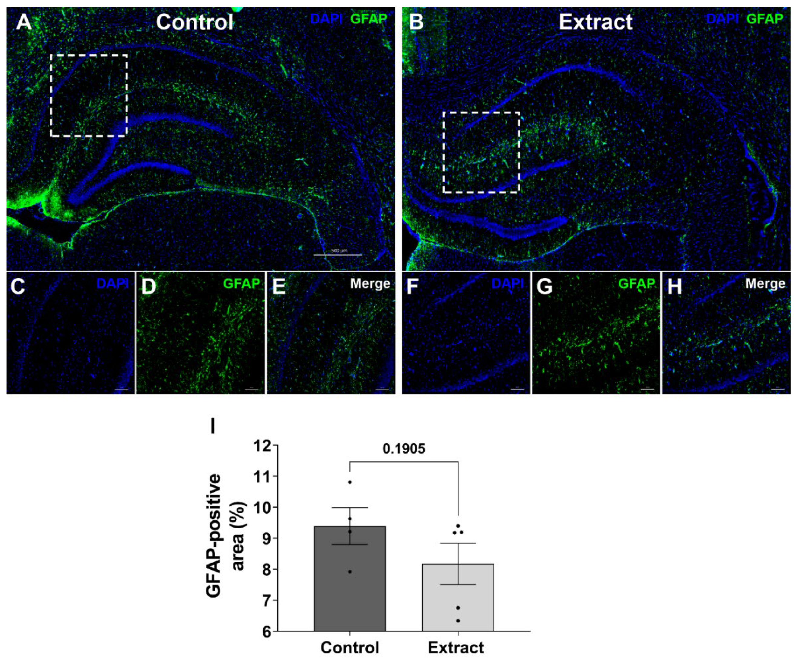Ijms 24 11775 g004 Ijms 24 11775 g004
