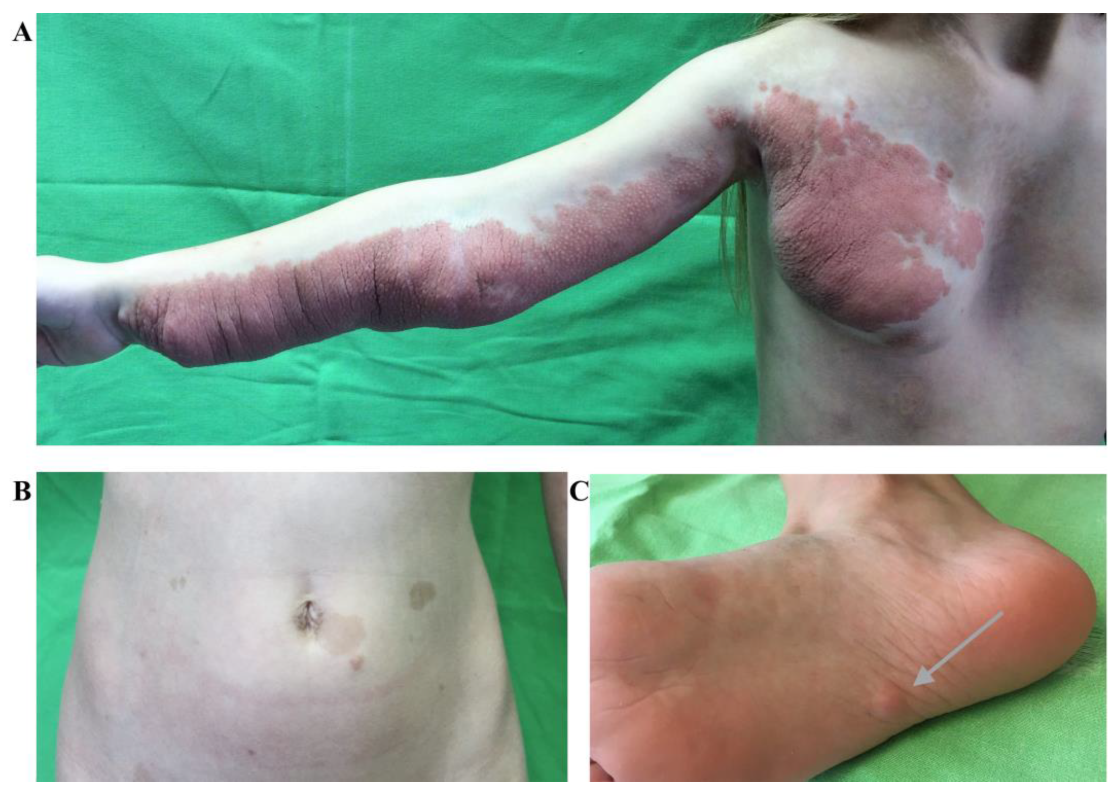 Ijms 24 12154 g002 Ijms 24 12154 g002