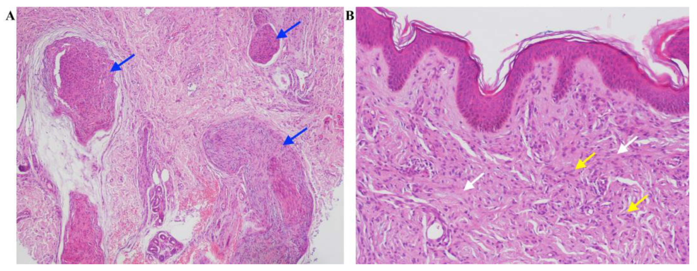 Ijms 24 12154 g003 Ijms 24 12154 g003