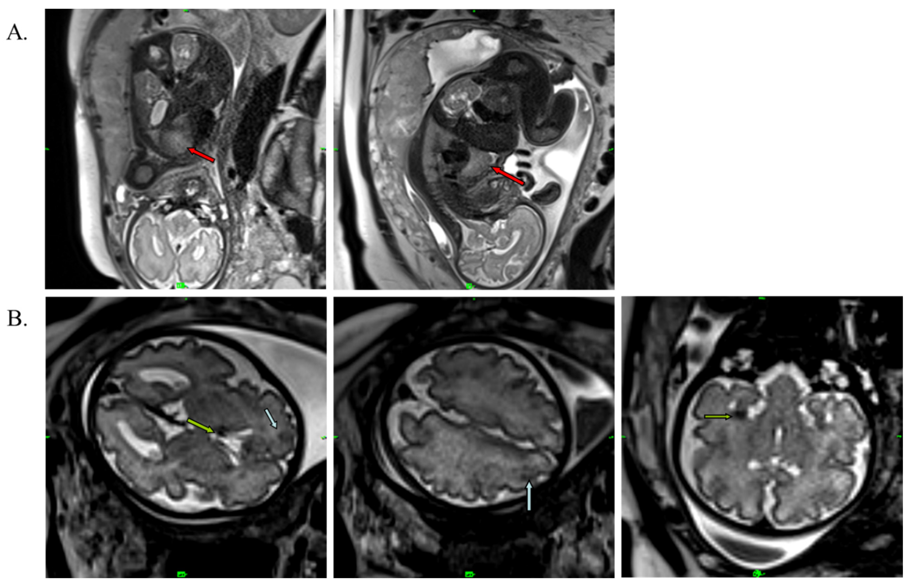 Ijms 24 12886 g001 Ijms 24 12886 g001