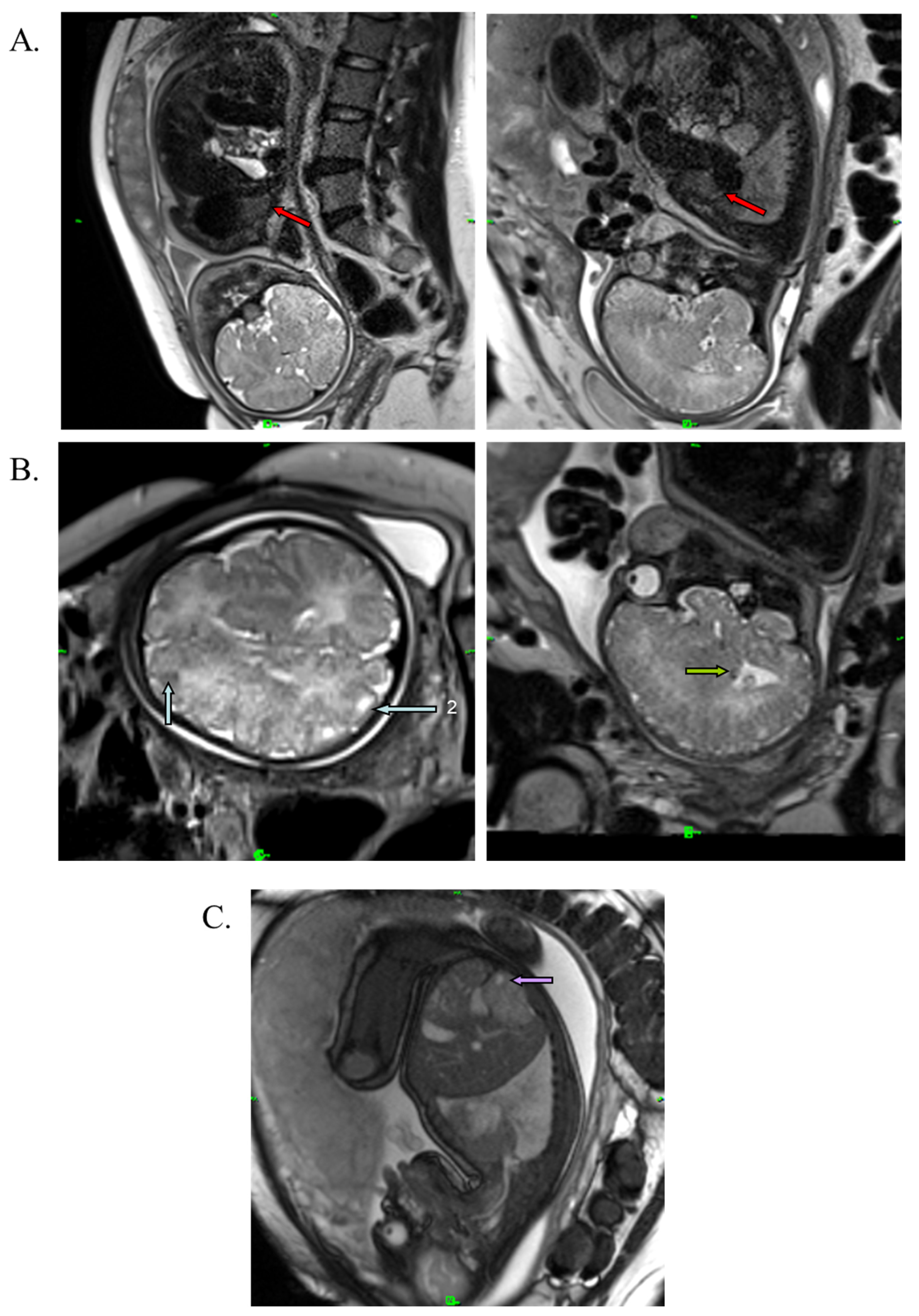 Ijms 24 12886 g003 Ijms 24 12886 g003