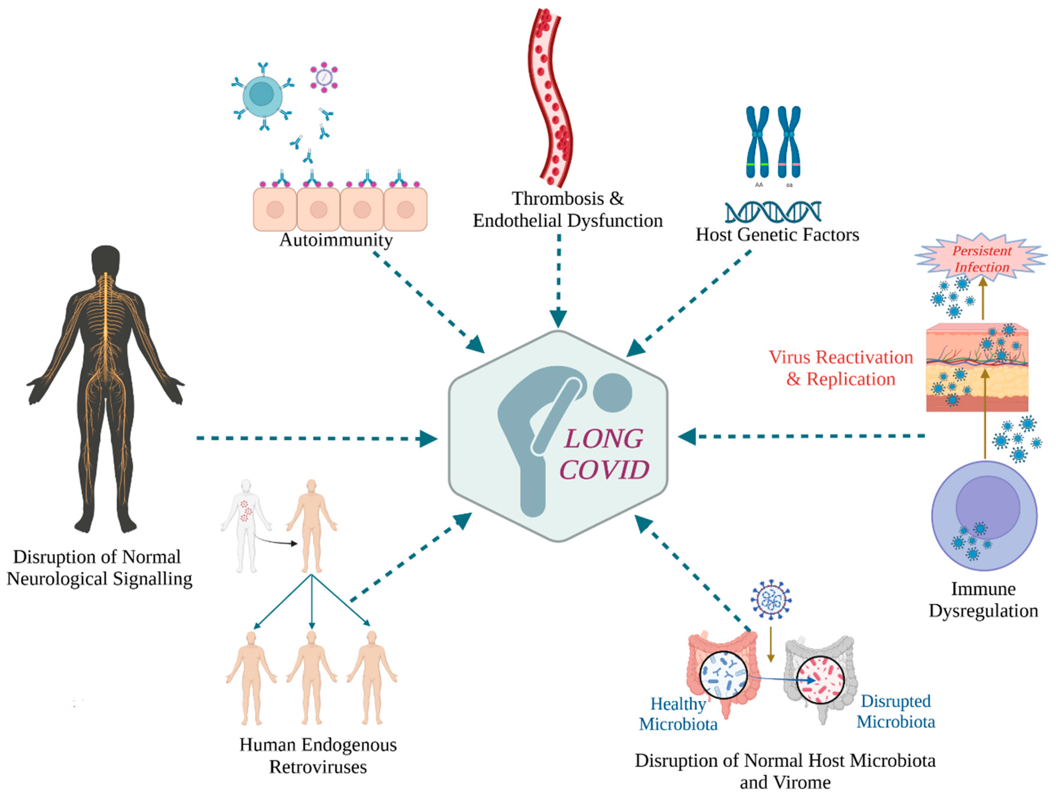 IJMS Free FullText SARSCoV2 Reinfections and Long COVID in the