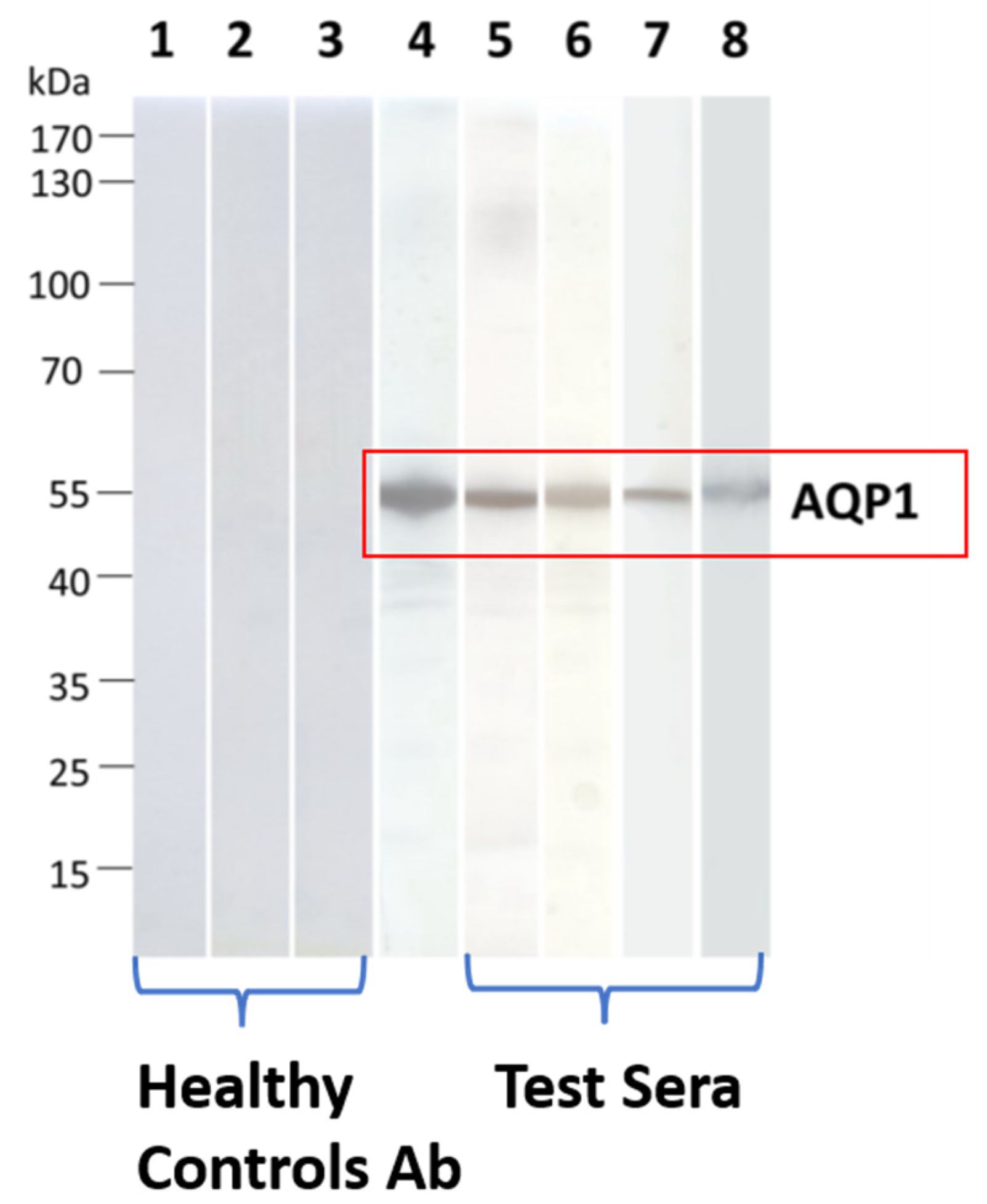 Ijms 24 12982 g003 Ijms 24 12982 g003