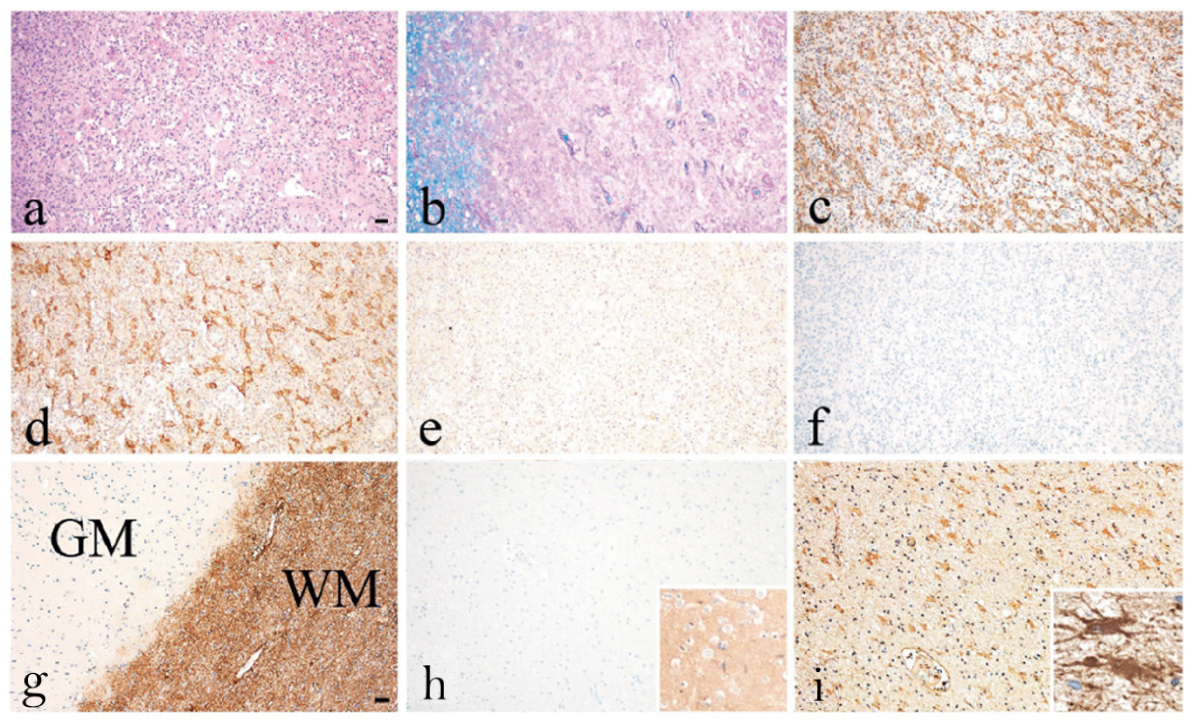 Ijms 24 12982 g006 Ijms 24 12982 g006