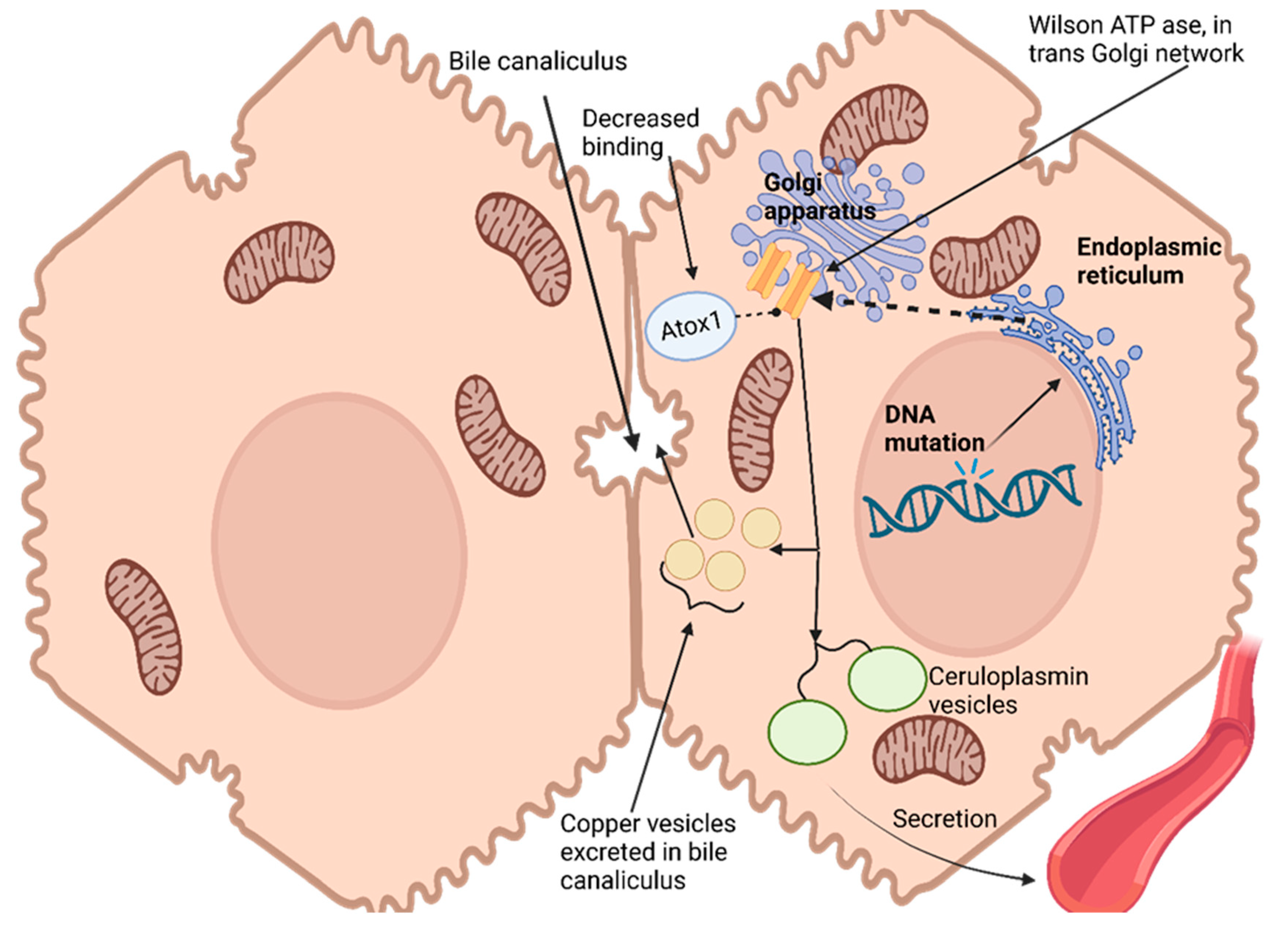 Gene therapy shows promise for treating Niemann-Pick disease type C1