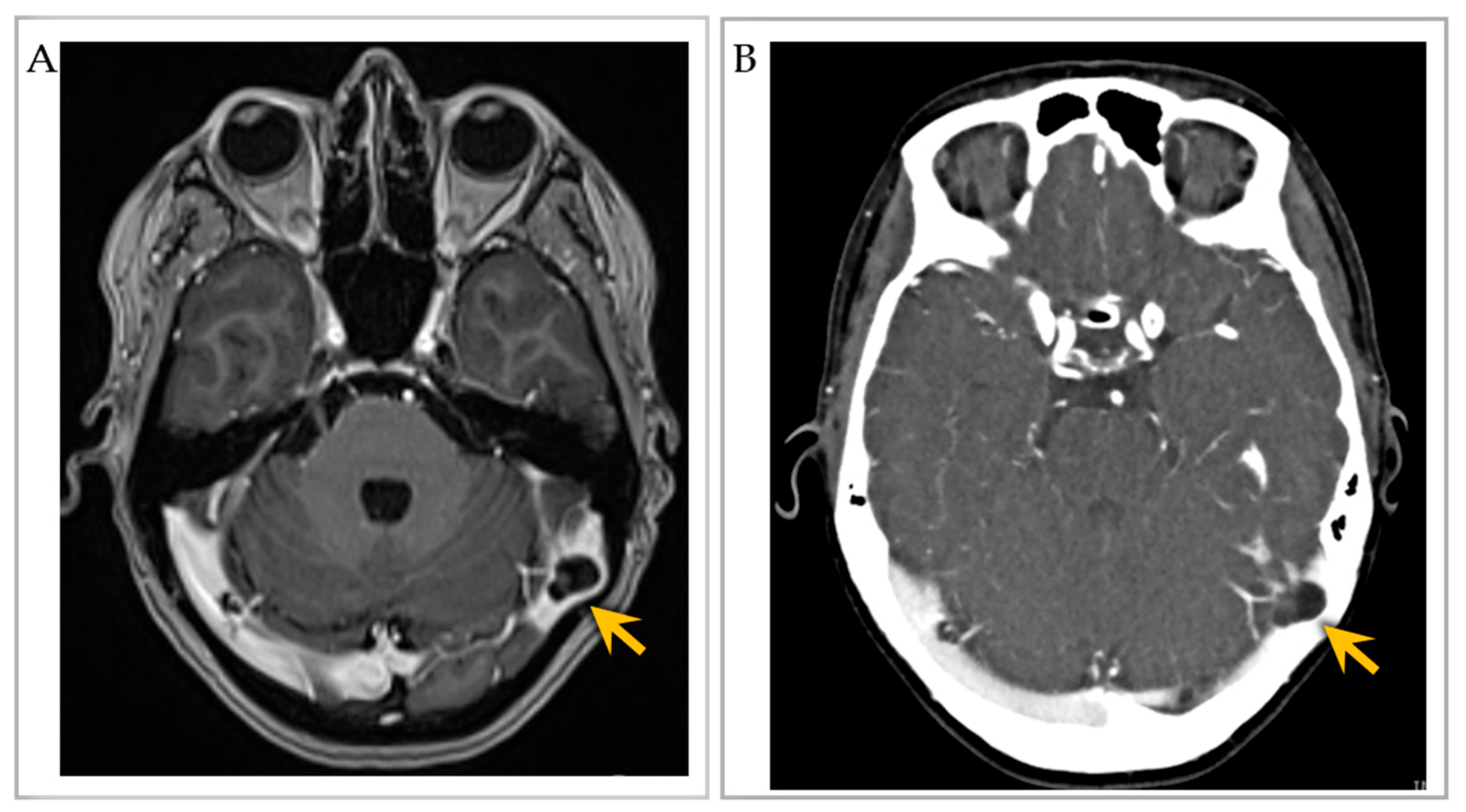 Ijms 24 13014 g004 Ijms 24 13014 g004