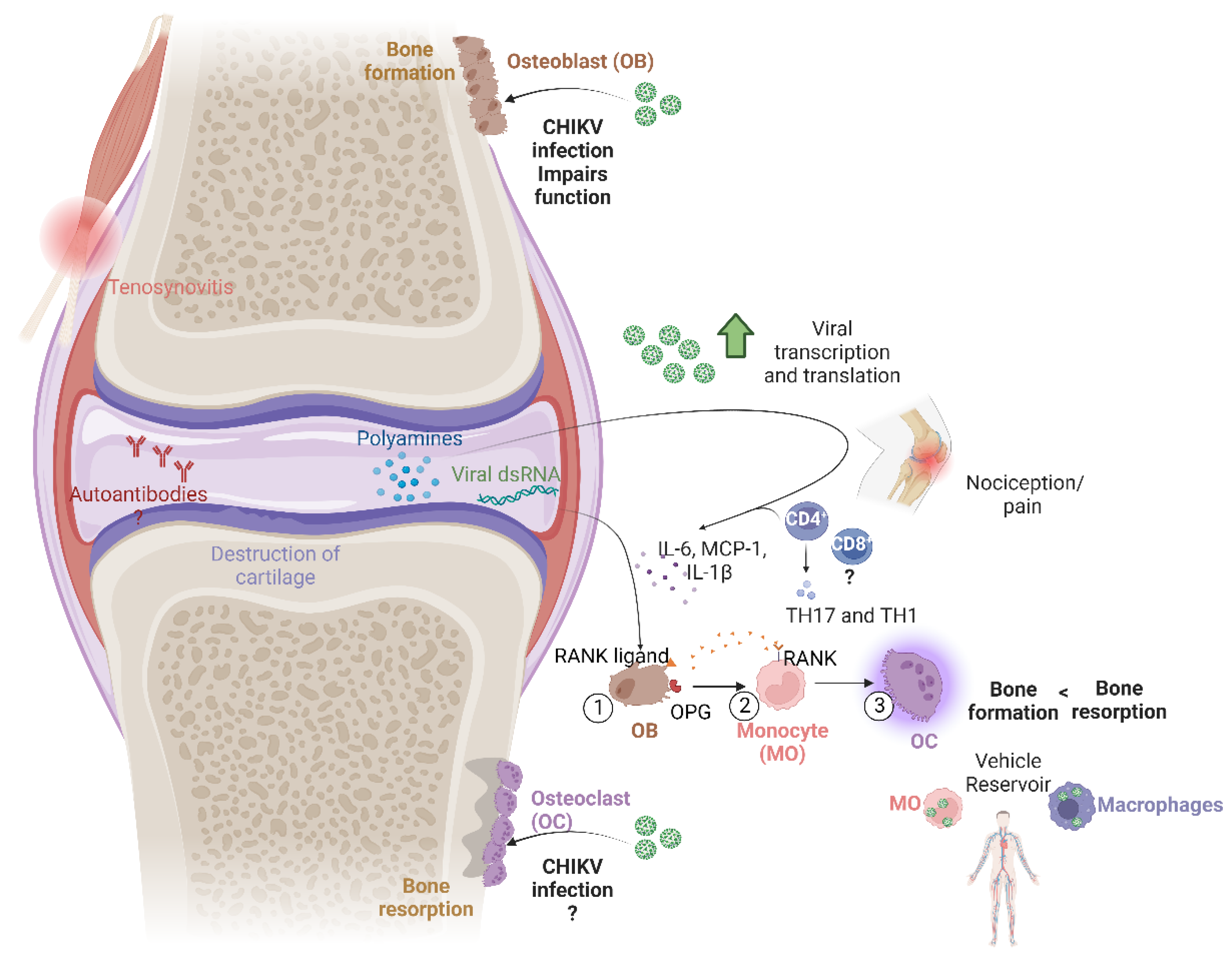 ijms-free-full-text-multiple-factors-involved-in-bone-damage-caused