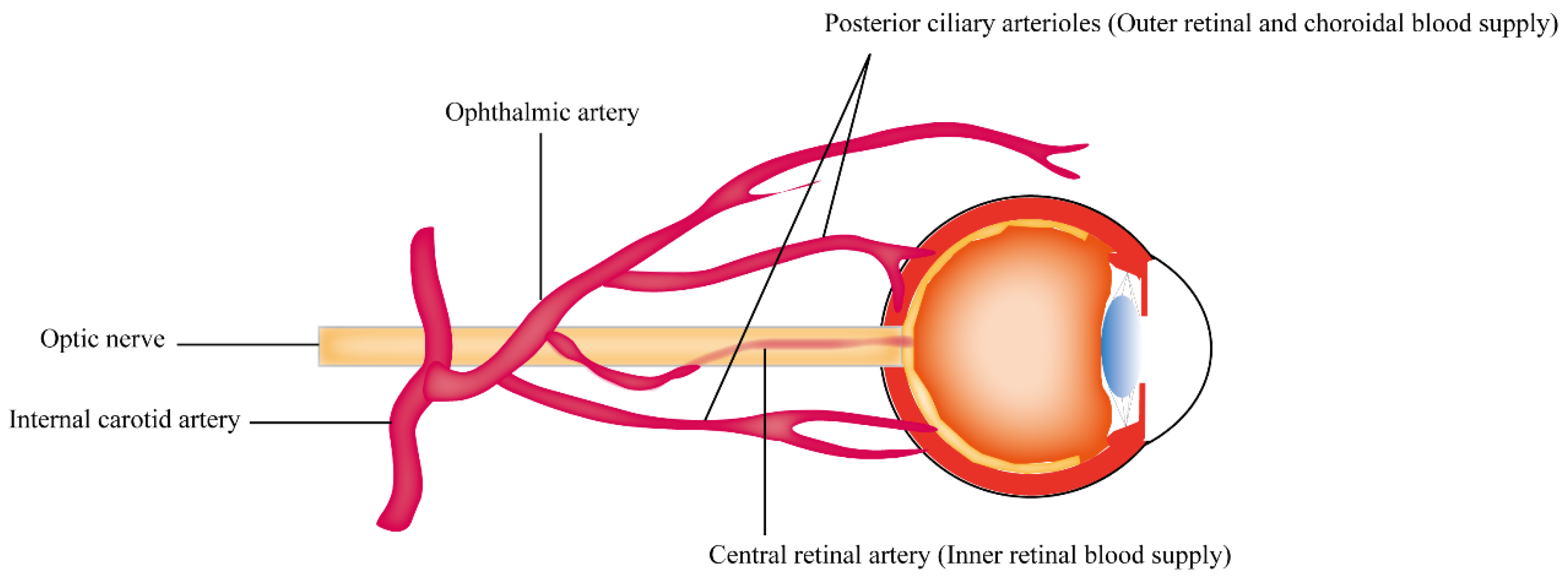 IJMS Free Full-Text The Association between Vascular Abnormalities and Glaucomaandmdash;What Comes First?