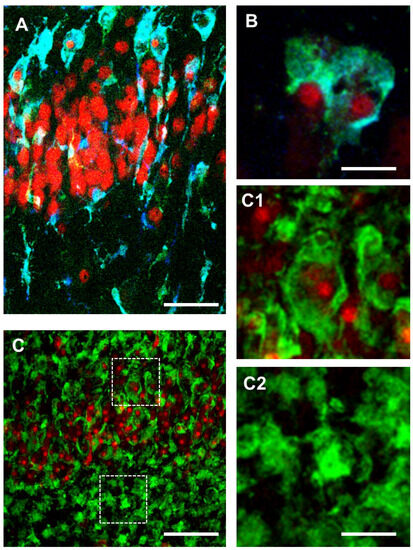 Phenomic Microglia Diversity as a Druggable Target in the
