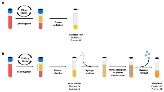 New Formulation of Platelet-Rich Plasma Enriched in Platelet and