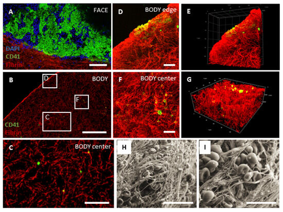 The Effect of Leukocyte- and Platelet-Rich Fibrin on Central and