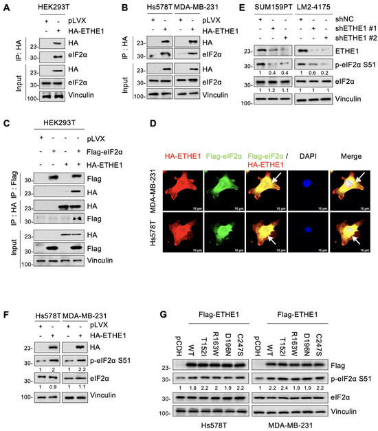 マリン ETHE1 Accelerates Triple-Negative Breast Cancer Metastasis
