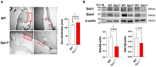 The Pulmonary Endothelial Glycocalyx Modifications in