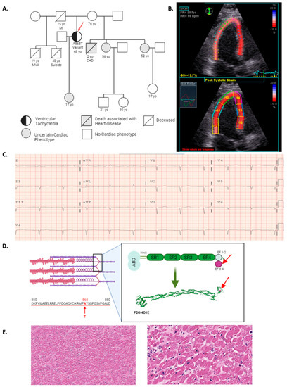 Disruption of Z-Disc Function Promotes Mechanical Dysfunction in