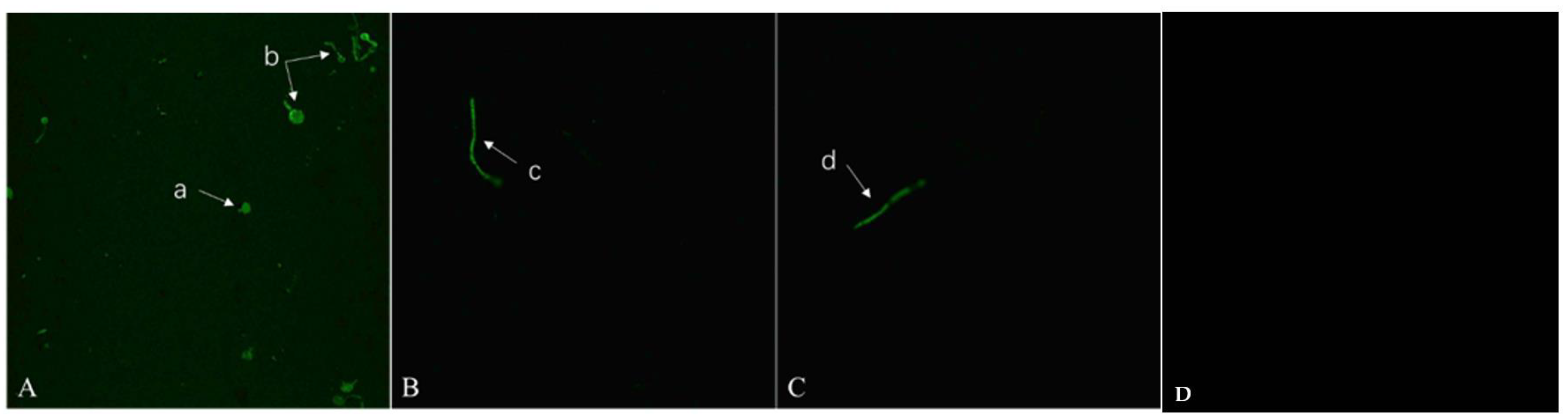 Ijms 24 15120 g006 Ijms 24 15120 g006